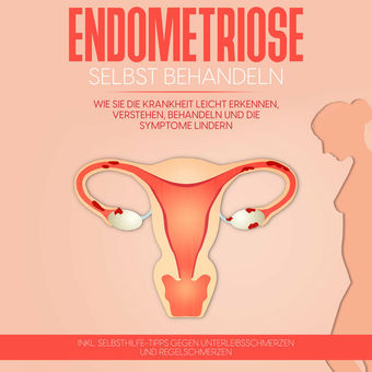 Endometriose selbst behandeln: Wie Sie die Krankheit leicht erkennen, verstehen, behandeln und die Symptome lindern - inkl. Selbst