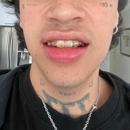 ''