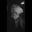 Cover One Dollar