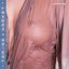 Cover Affection