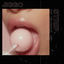 Cover Strip