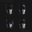 Cover Elastic Heart (Rock Version)