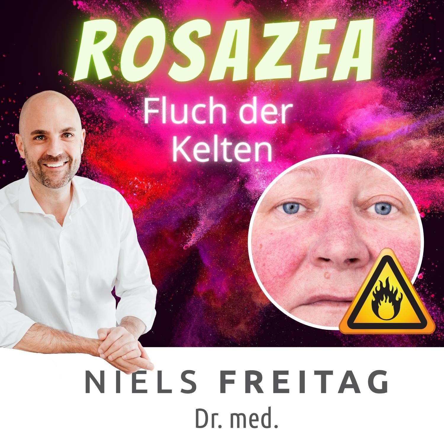 #15 Rosazea - Fluch der Kelten
