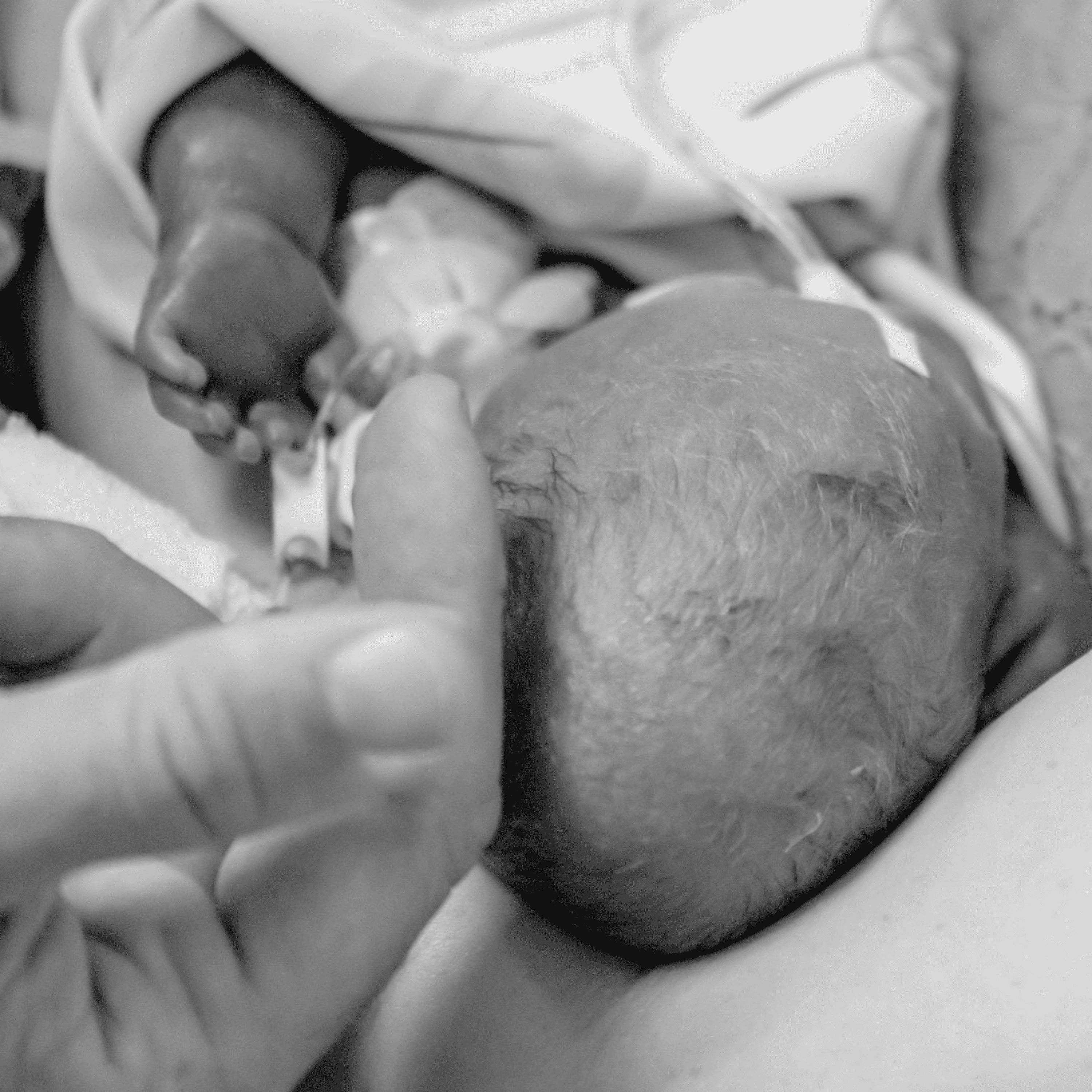 176 | Marianne - Eine Geburtshausgeburt & ein Kaiserschnitt bei 24+4, starke Blutungen, vorzeitiger Blasensprung, Neonatologie, Kindstod