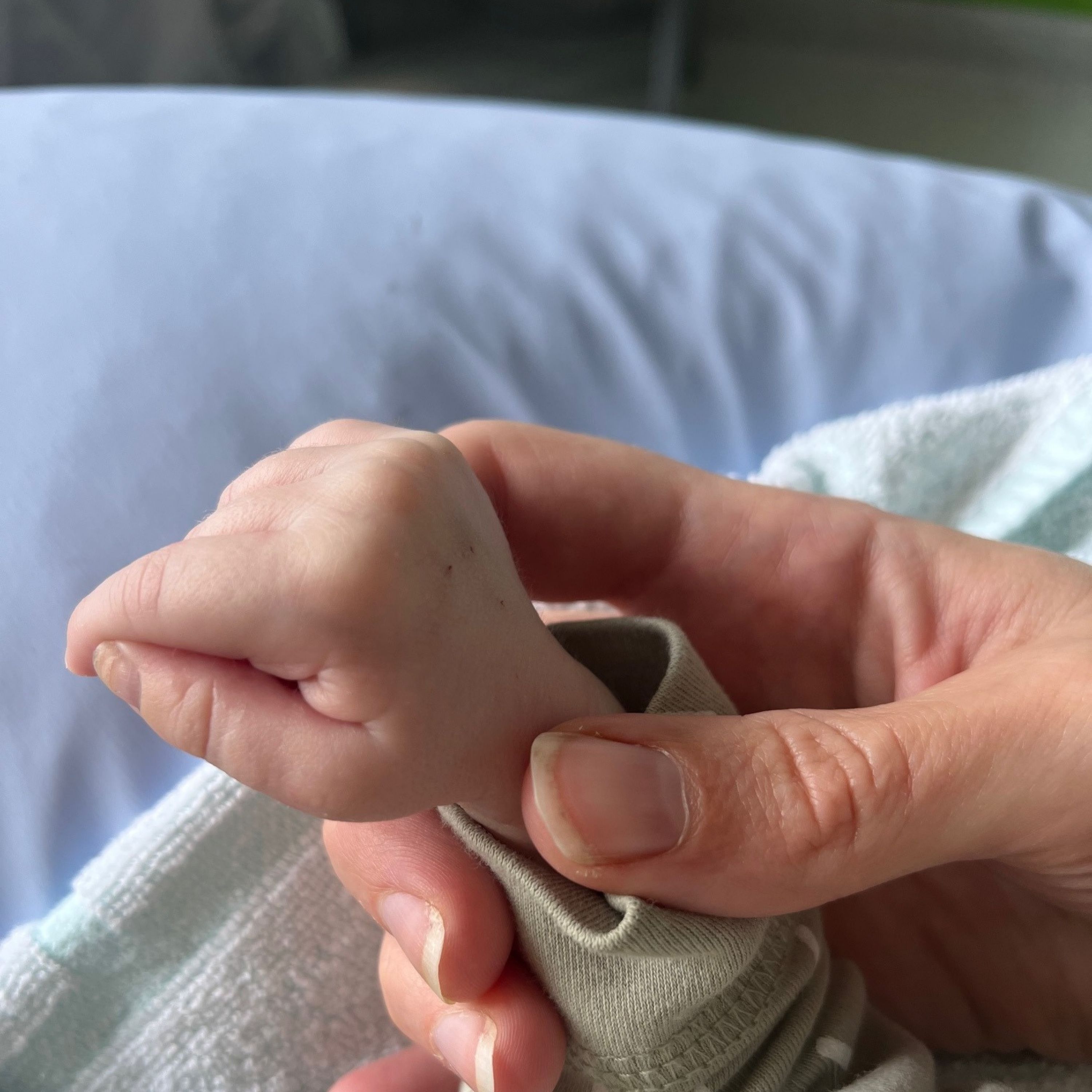 195 | Sophie - 2 Krankenhausgeburten, Hydrops Fetalis, Totale Lungenvenenfehlmündung, Kindstod mit 15 Wochen