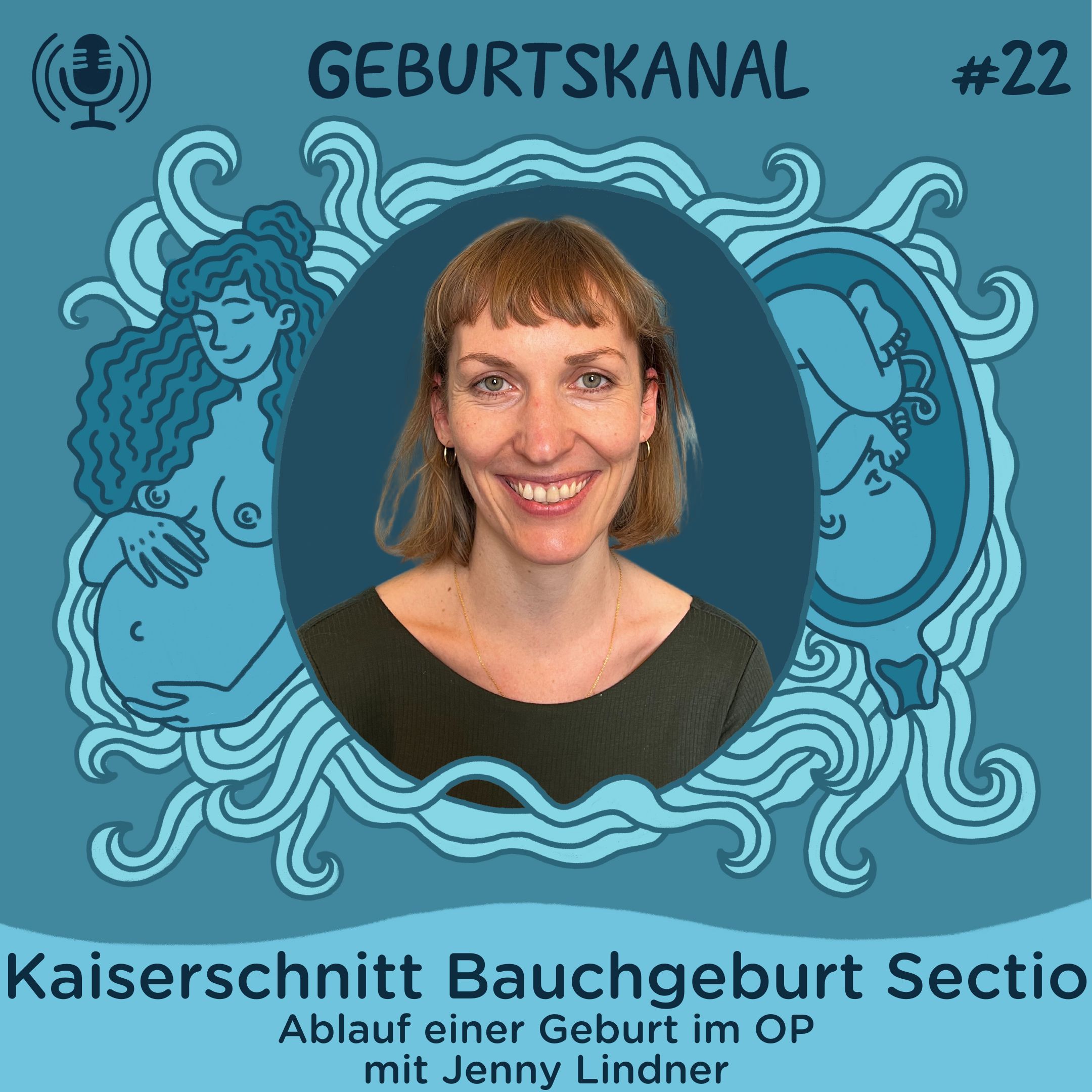 #22 Kaiserschnitt - Bauchgeburt - Sectio: Ablauf einer Geburt im OP