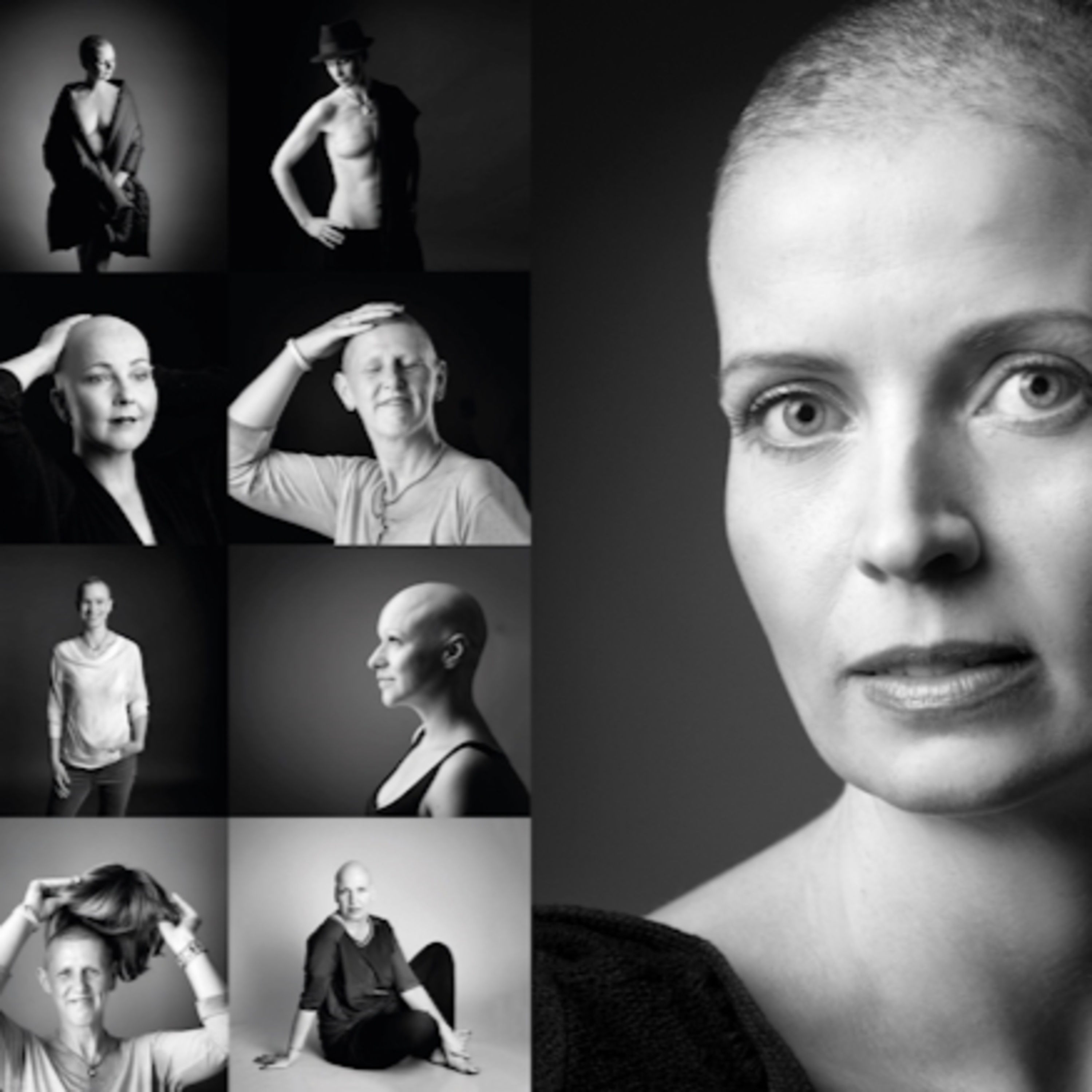 ⓦ 397 Beate Knappe zum Pink Oktober: Der Angst die Haare vom Kopf fressen - Stärke und Schönheit trotz Krebserkrankung