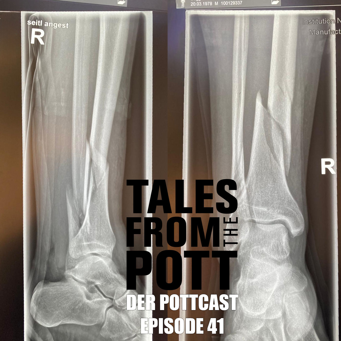 #41: Nur zwei im Pott – einer im Off