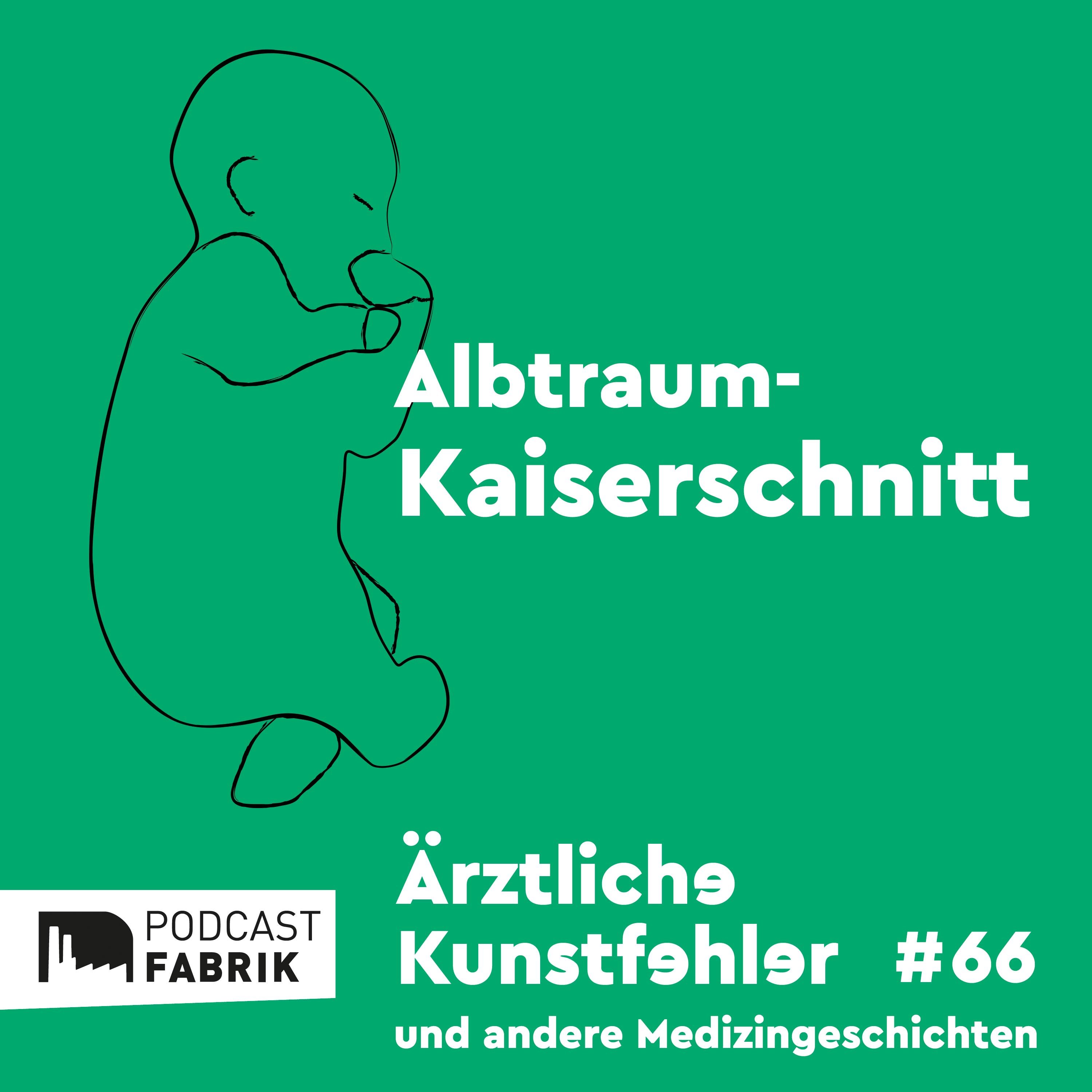 Albtraum-Kaiserschnitt