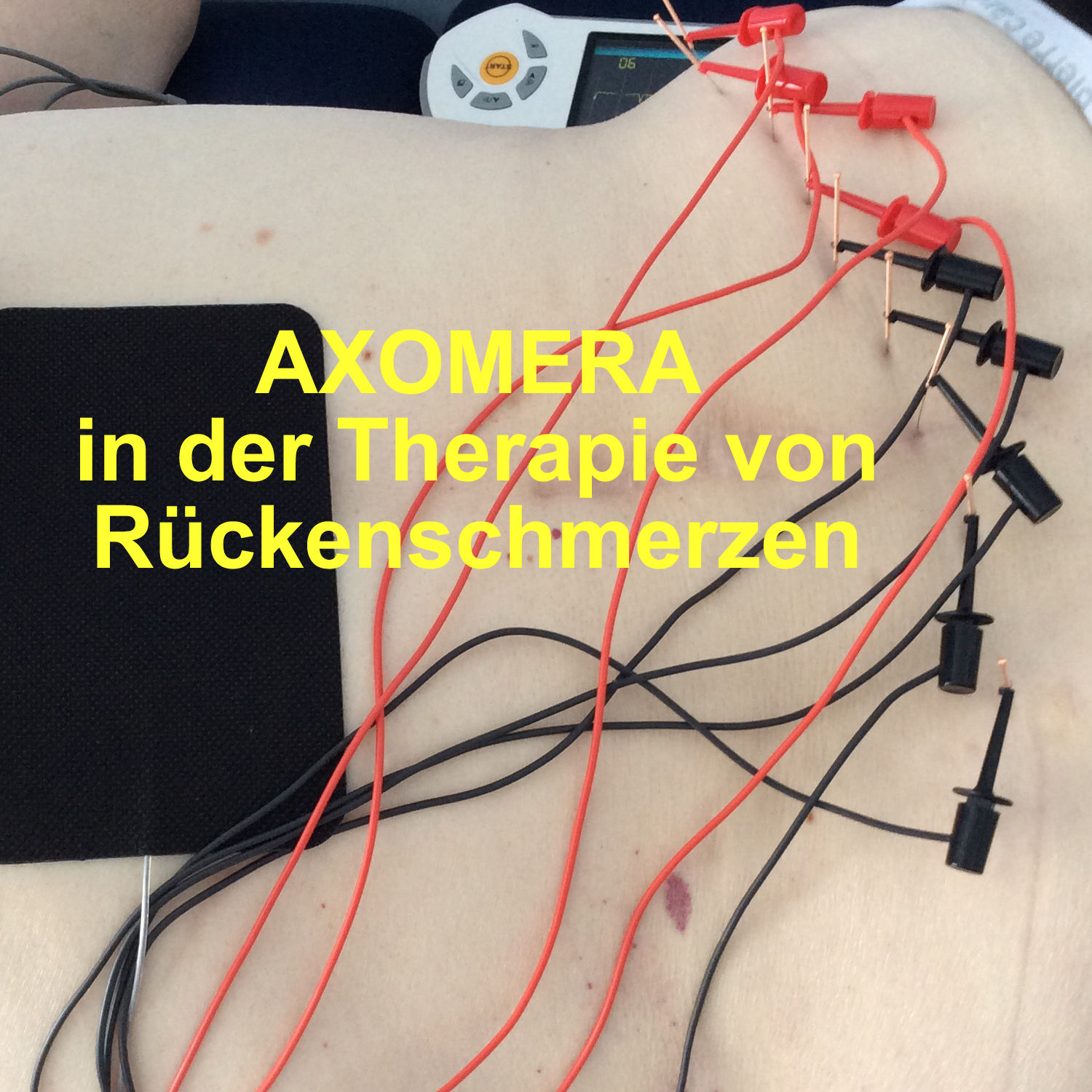 Axomera spezial - Wie kann Axomera bei Rückenschmerzen helfen