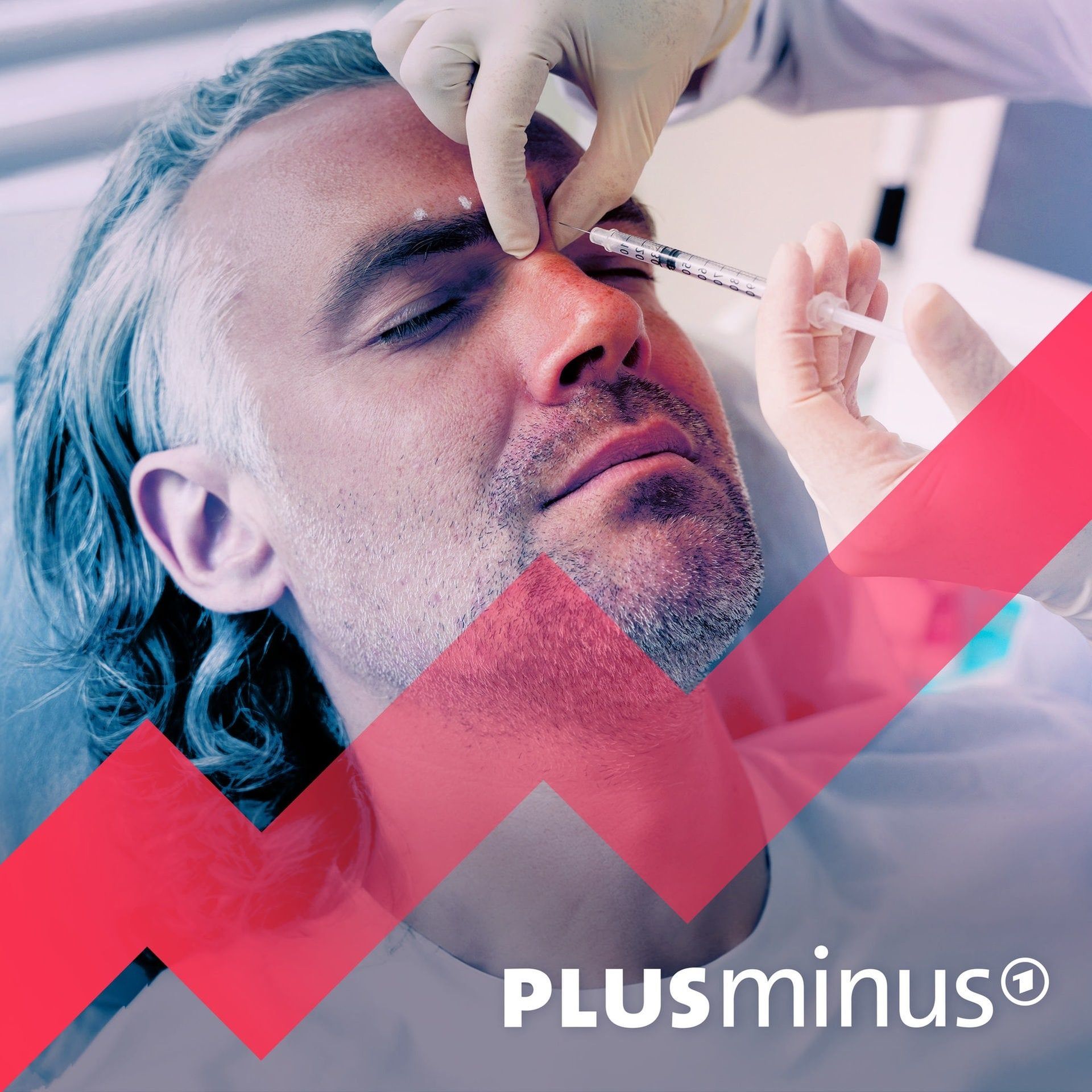 Botox & Co: Müssen Männer schön sein für den Erfolg im Job?