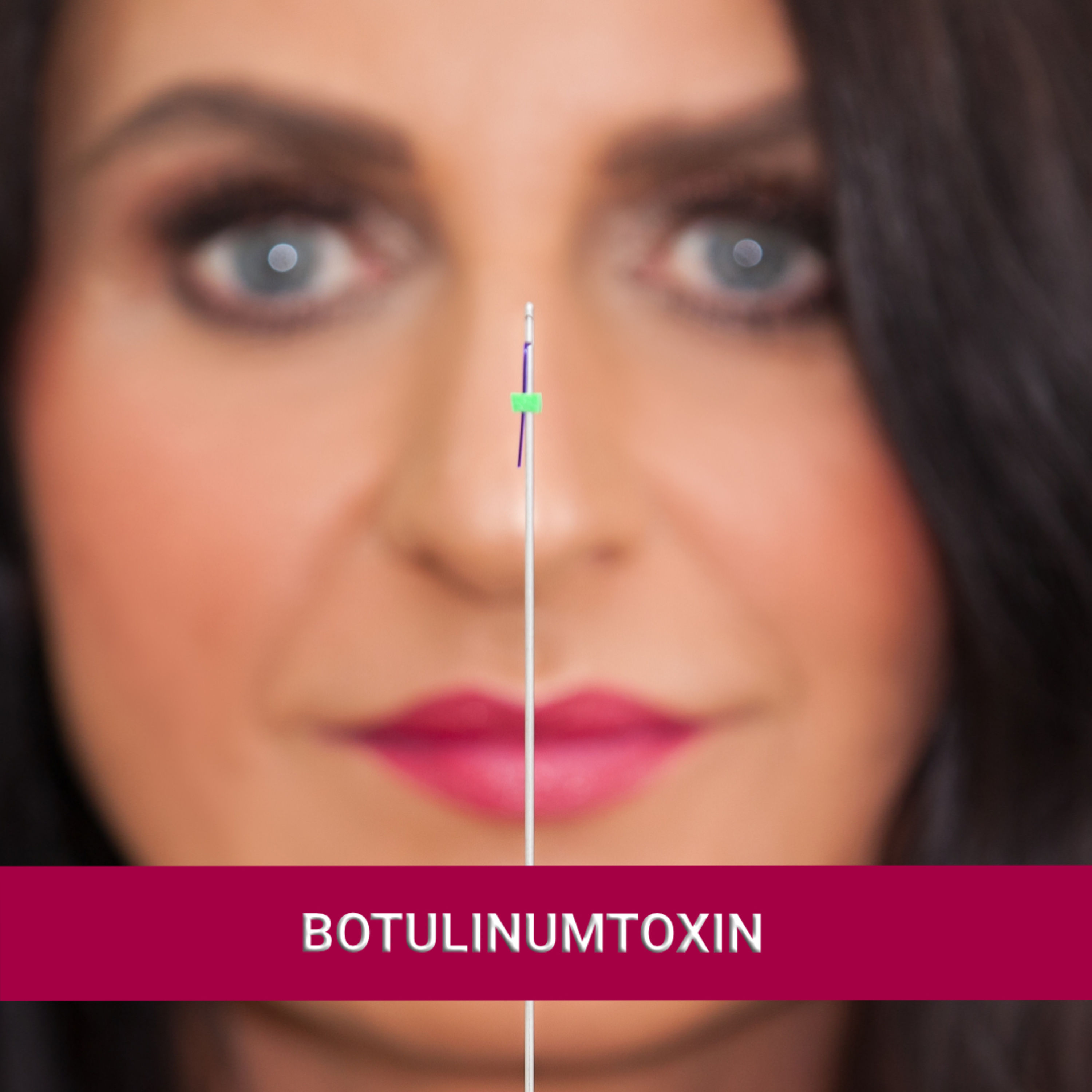 Botulinumtoxin