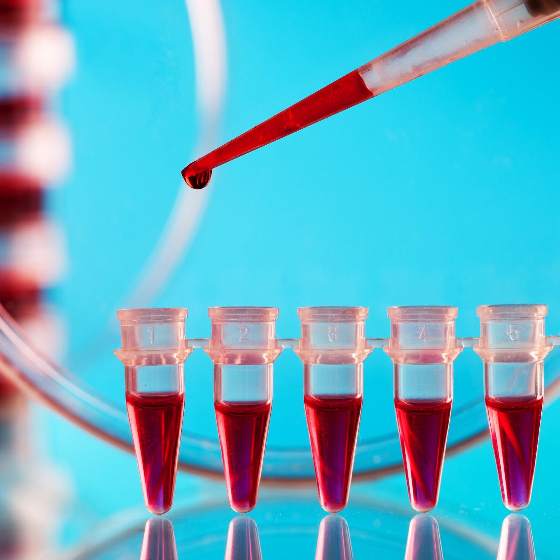 Chemikalien im Blut - So werden wir sie los