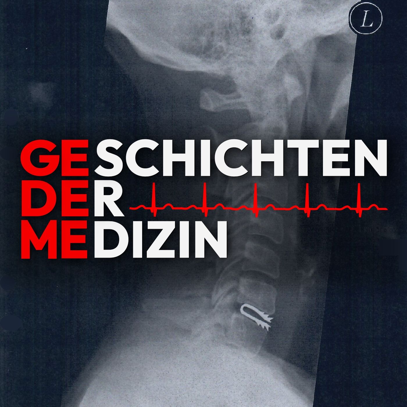 #008 Das ausgefallene Sterben