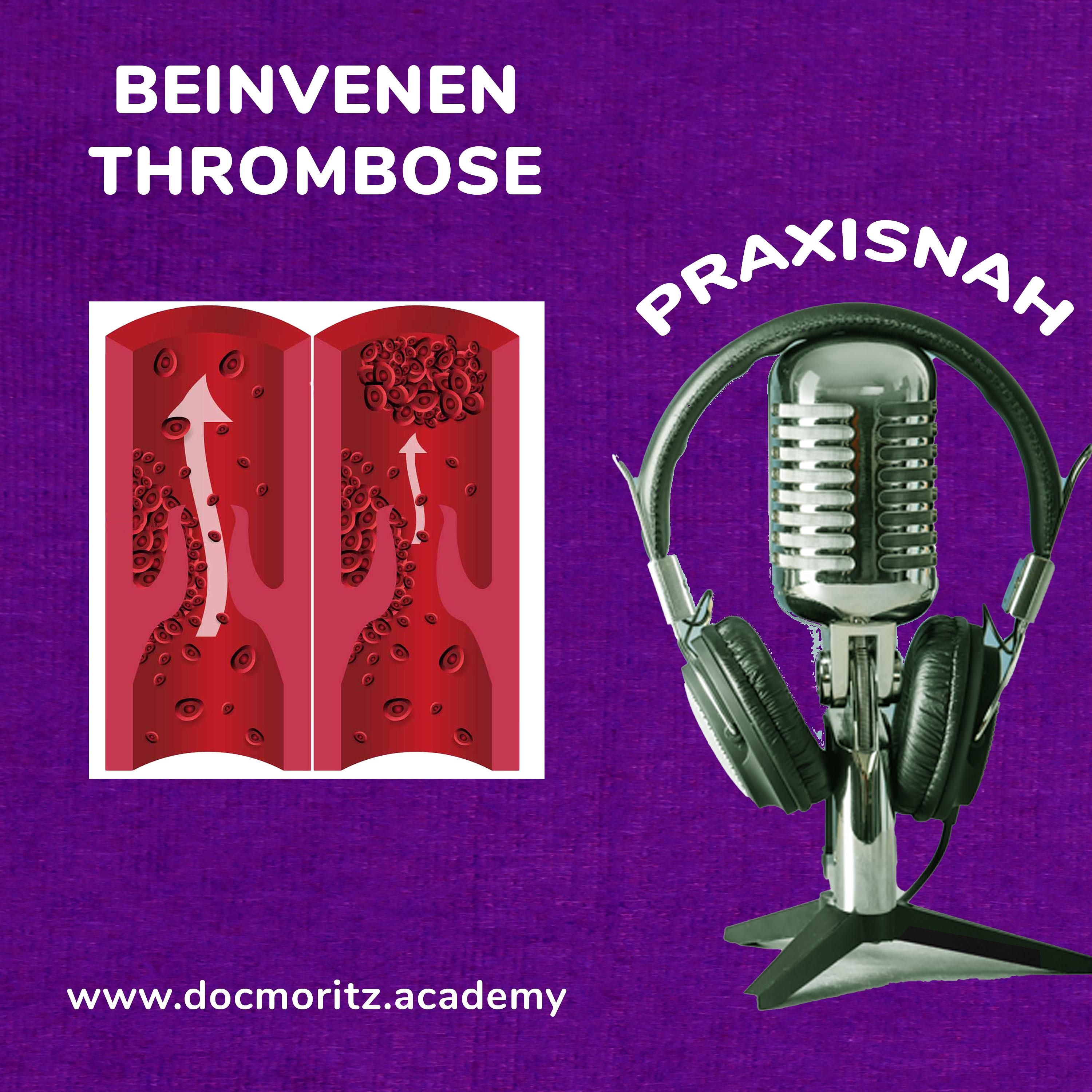 Die Thrombose