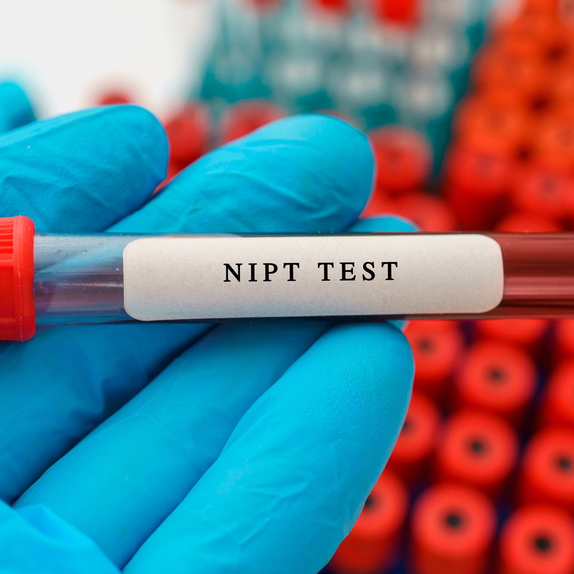 Diskussion um Pränataltest – Wann ist ein NIPT sinnvoll?