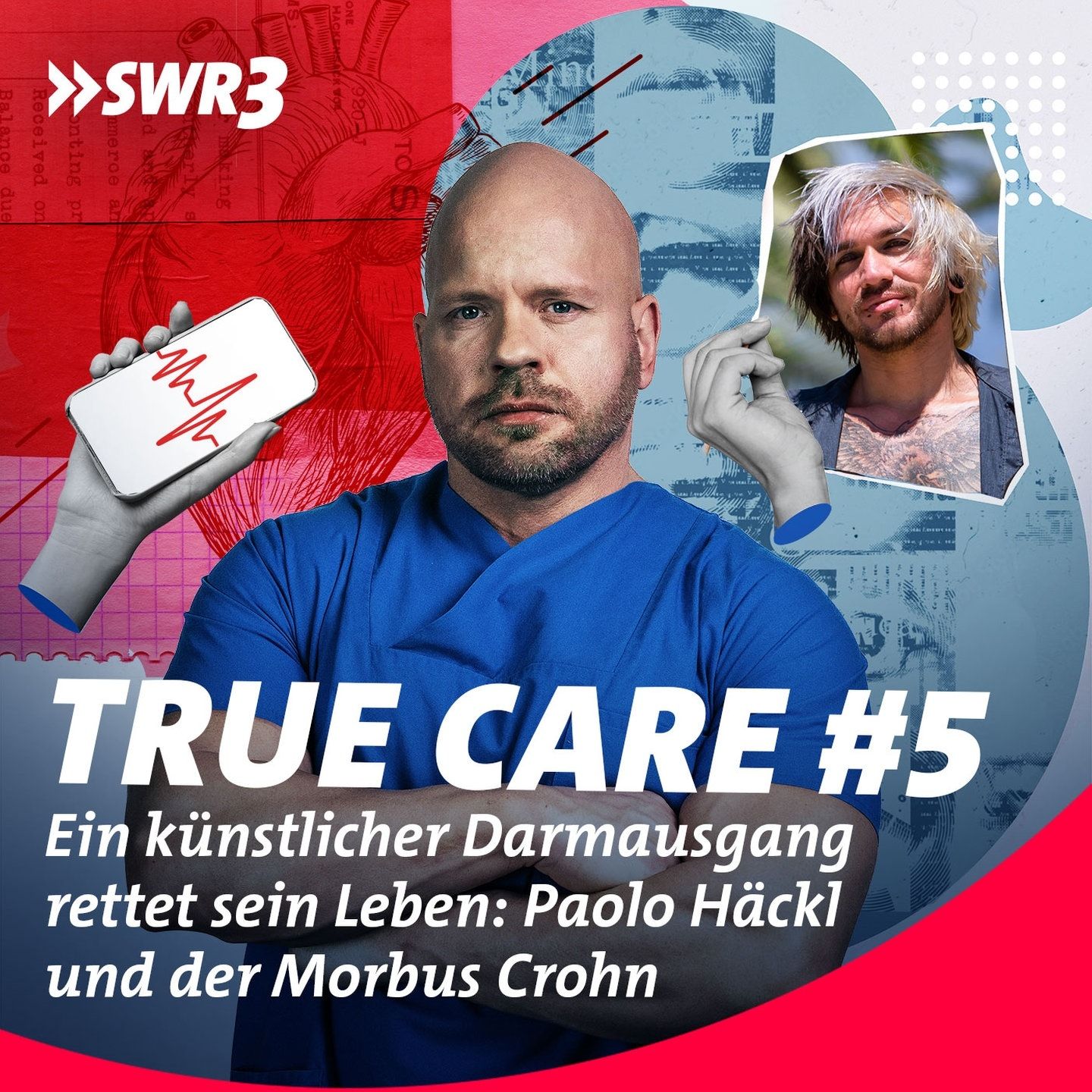 Ein künstlicher Darmausgang rettet sein Leben: Paolo Häckl und der Morbus Crohn