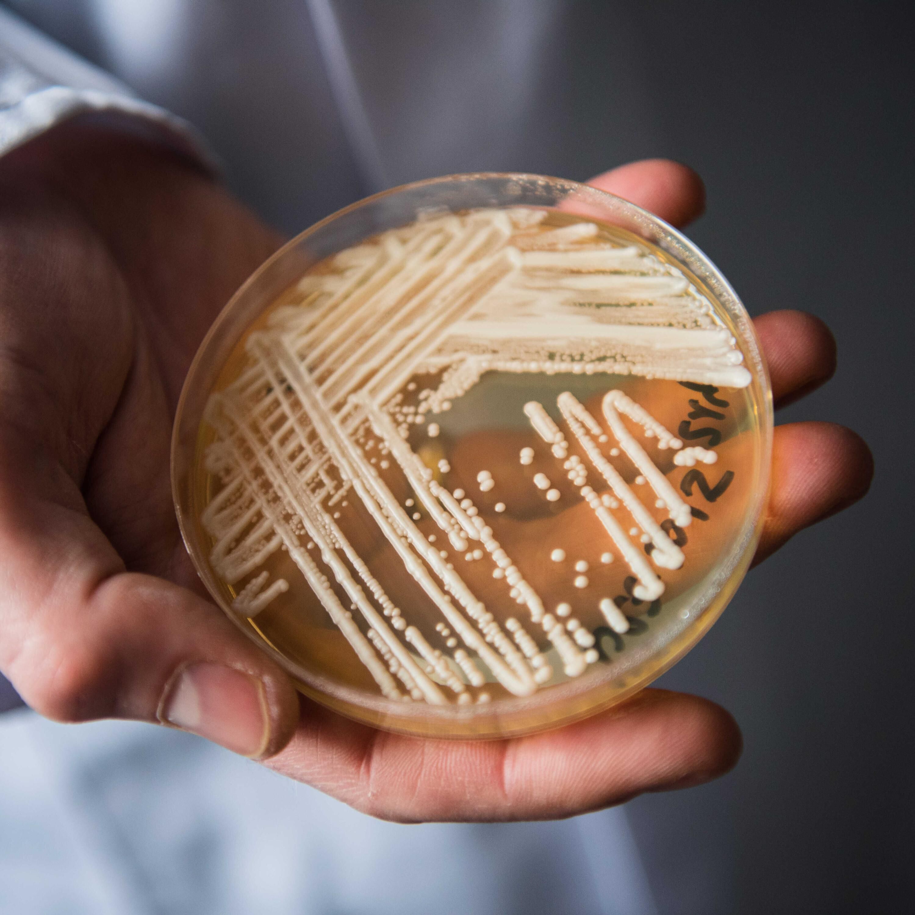 Ein tödlicher Pilz nistet sich in Europas Krankenhäusern ein