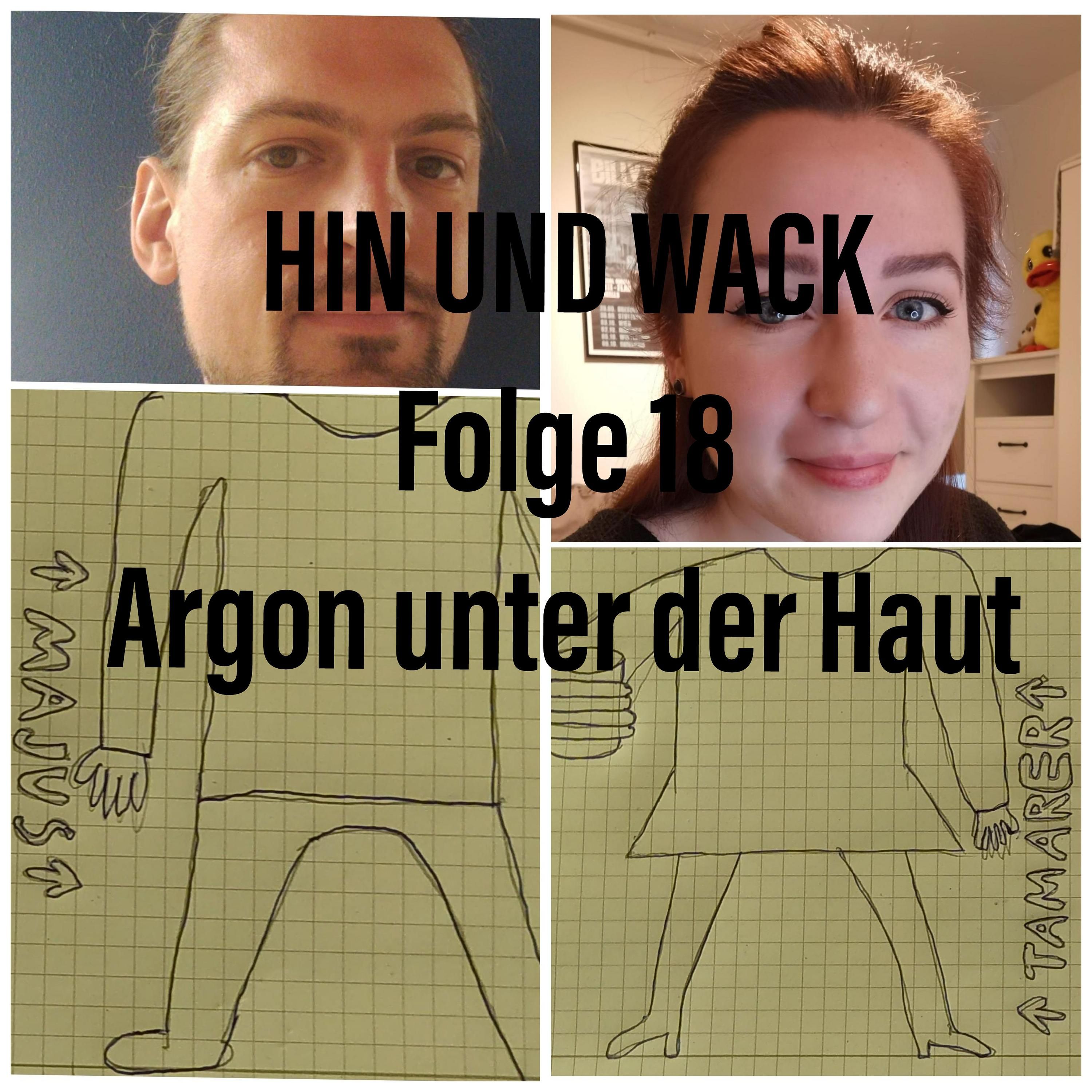 Folge 18 Argon unter der Haut