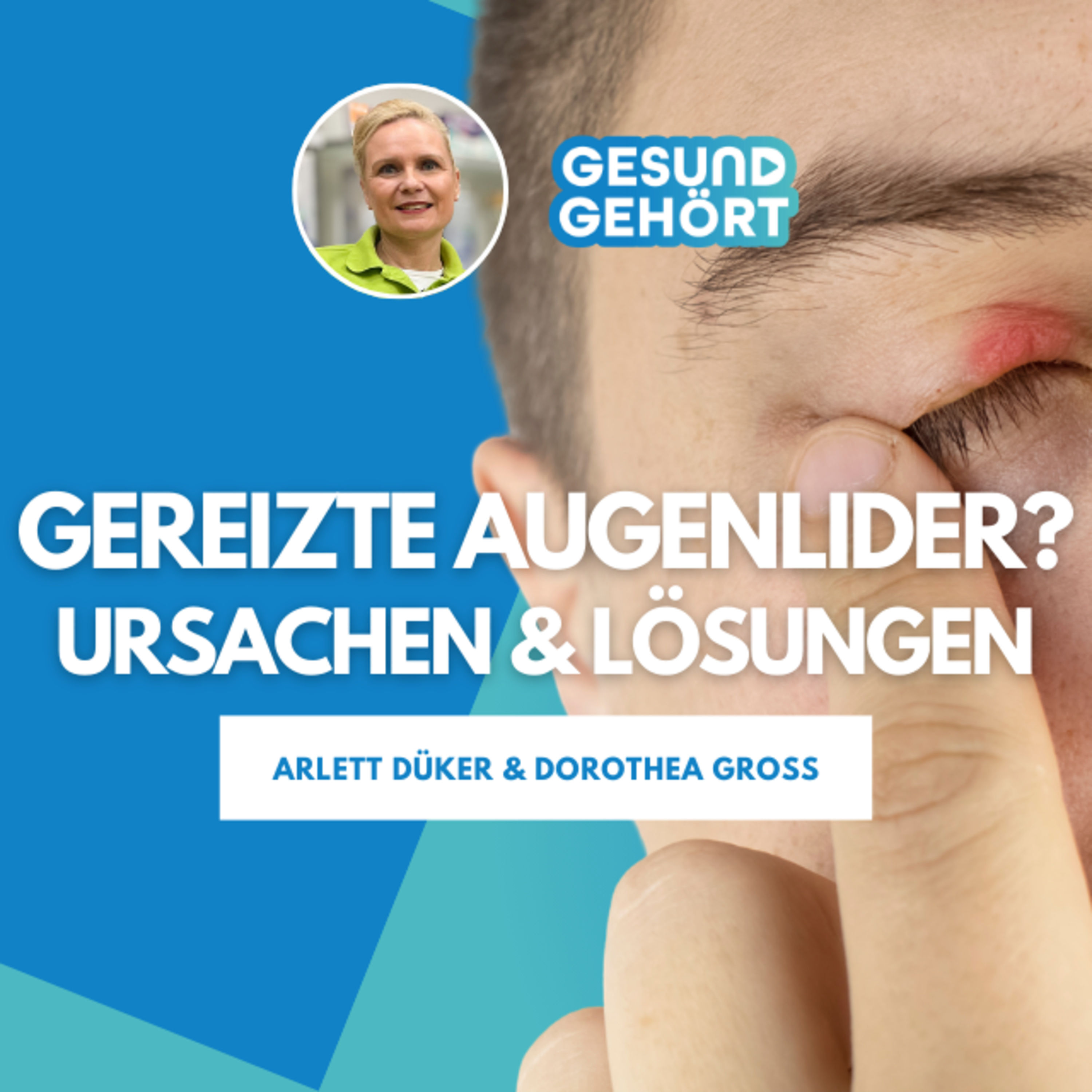Gereizte Augenlider? - Das sind die Ursachen & Lösungen