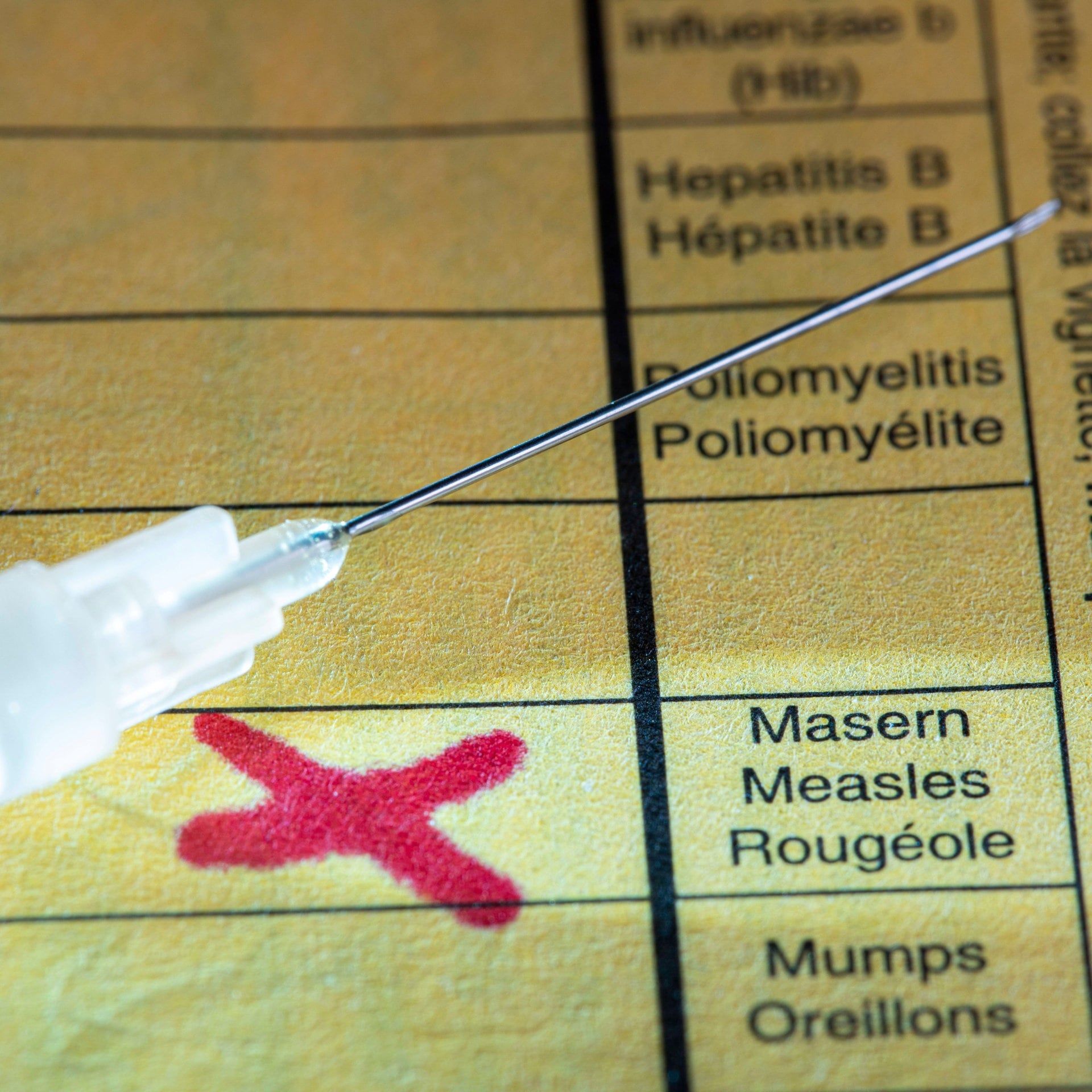 Großer Masernausbruch in London