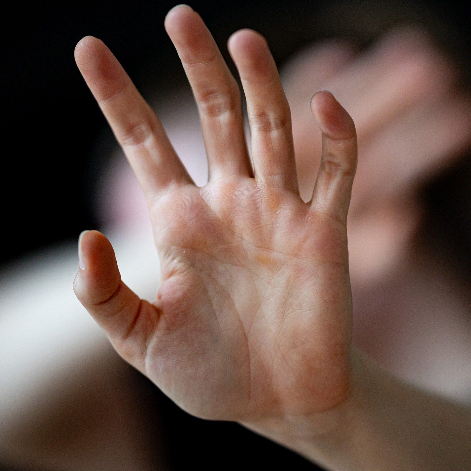 Häusliche Gewalt: Studie zeigt erschreckend hohe Dunkelziffer