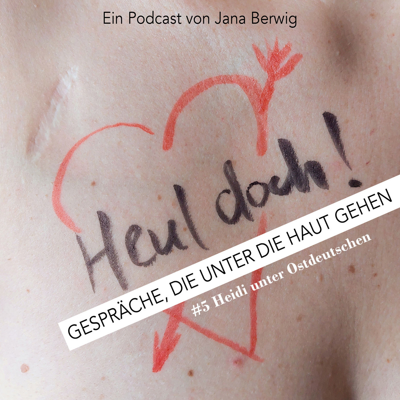 Heidi unter Ostdeutschen