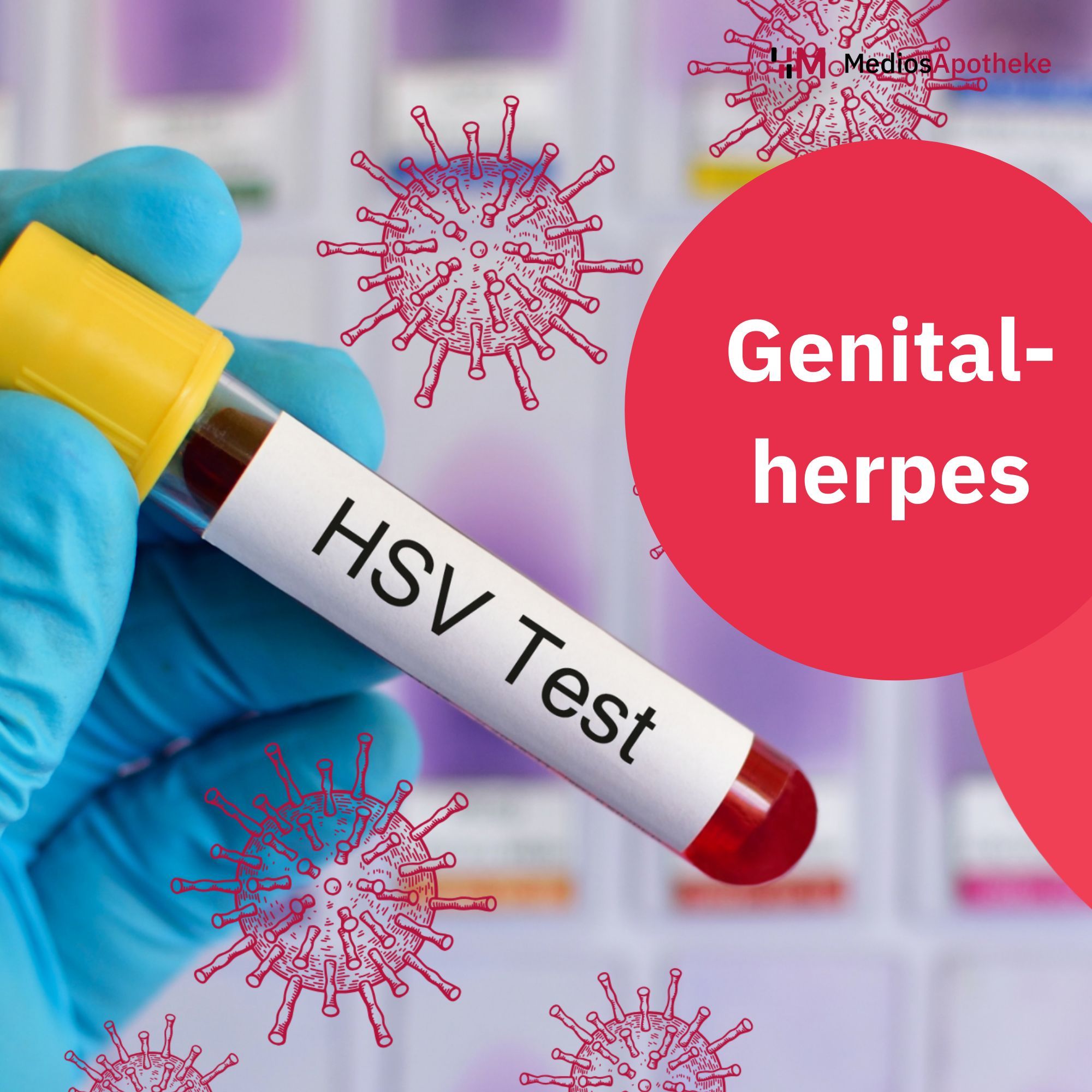Herpes Simplex! Das fiese Virus im Gesicht oder auch mal in der Unterhose? Wir klären auf!