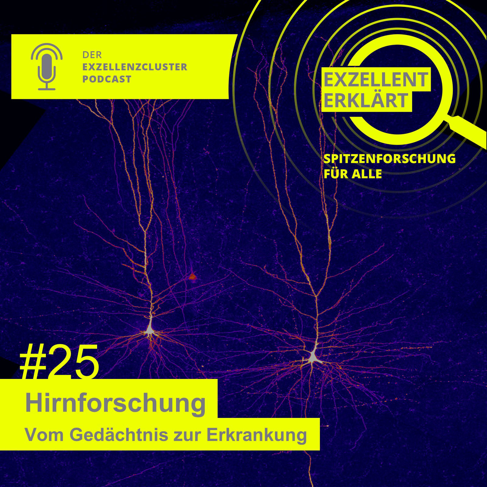 Hirnforschung - Vom Gedächtnis zur Erkrankung