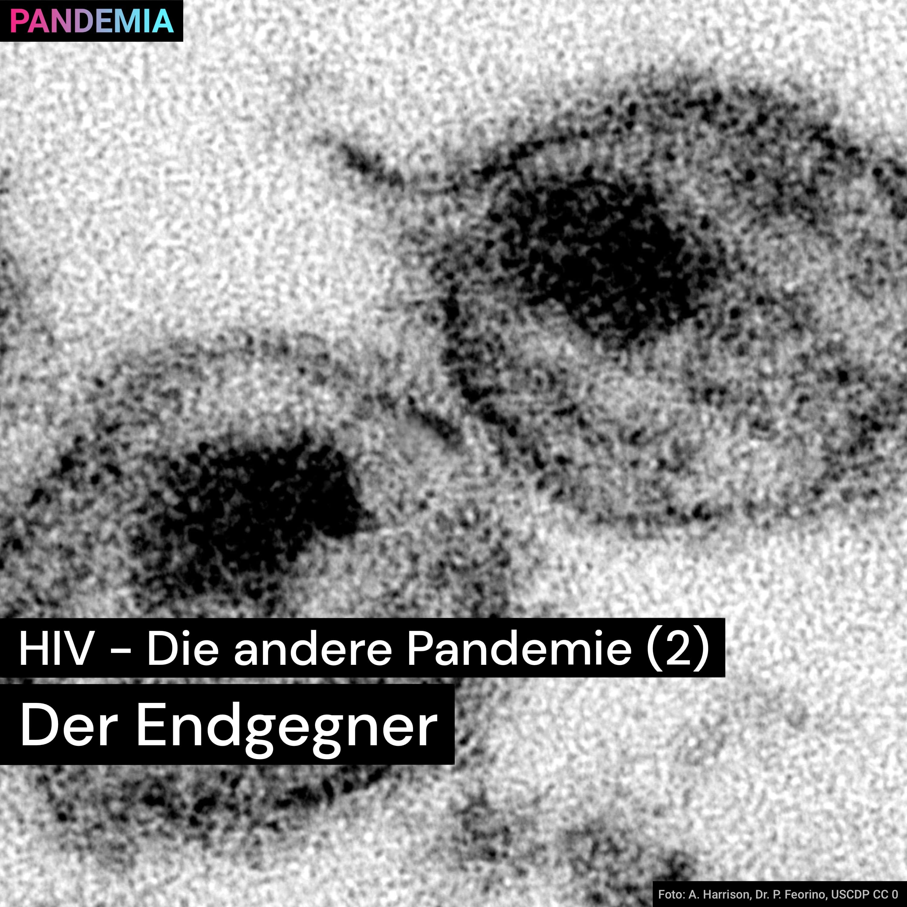 HIV – Die andere Pandemie (2) | Der Endgegner