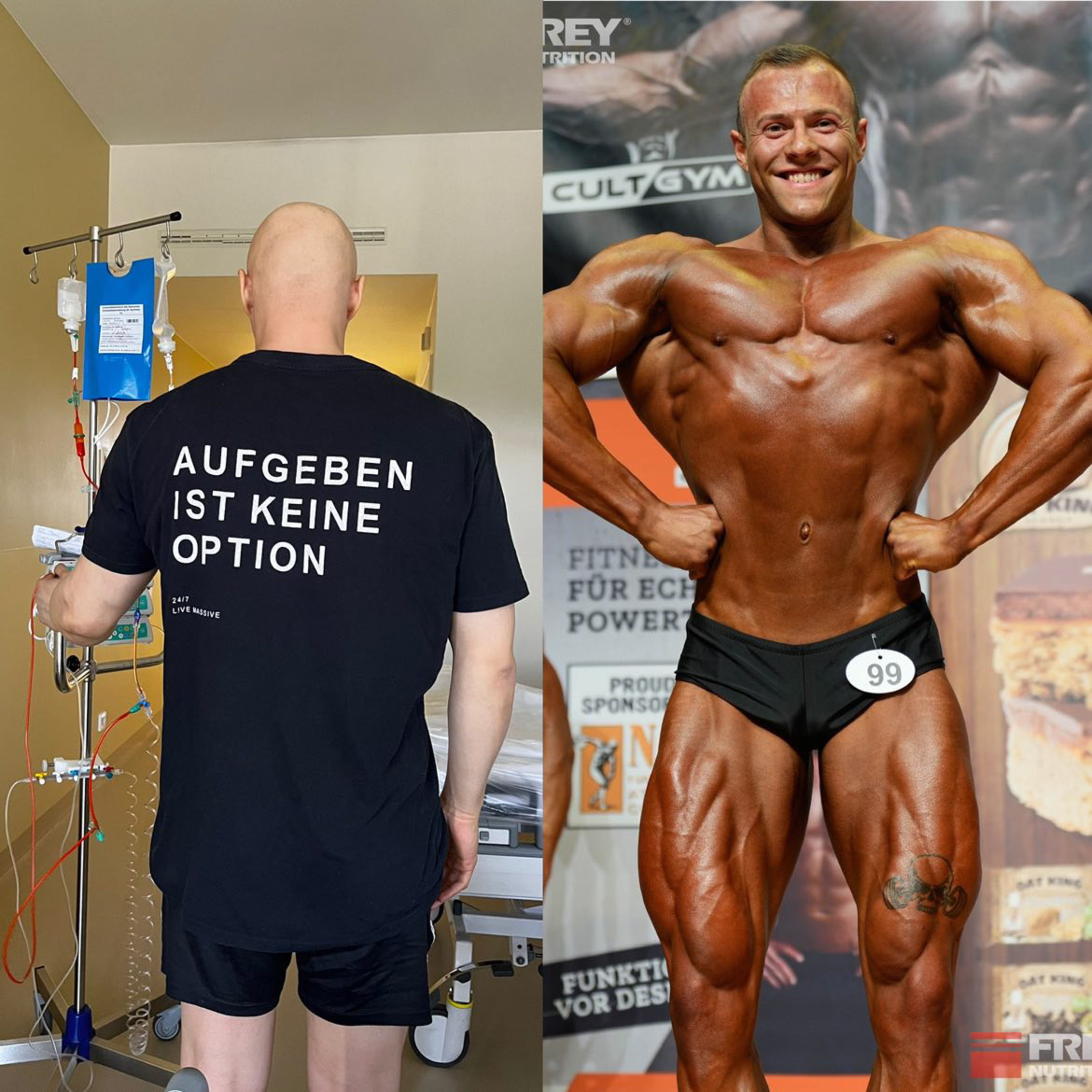 Julian: Knochenkrebs mit 26