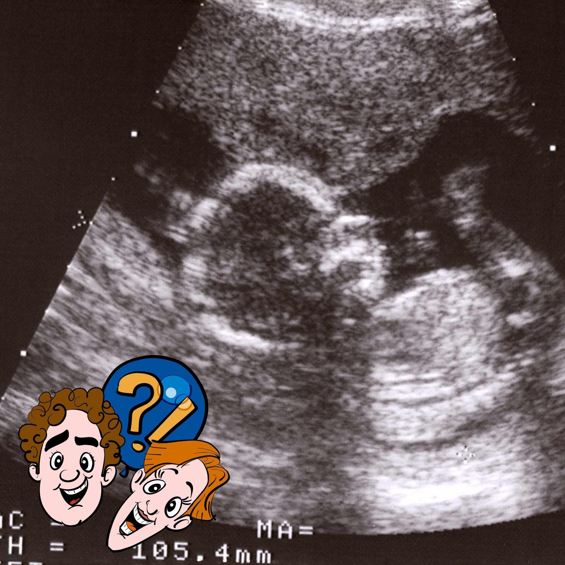 Können sich Babys im Bauch der Mama übergeben?
