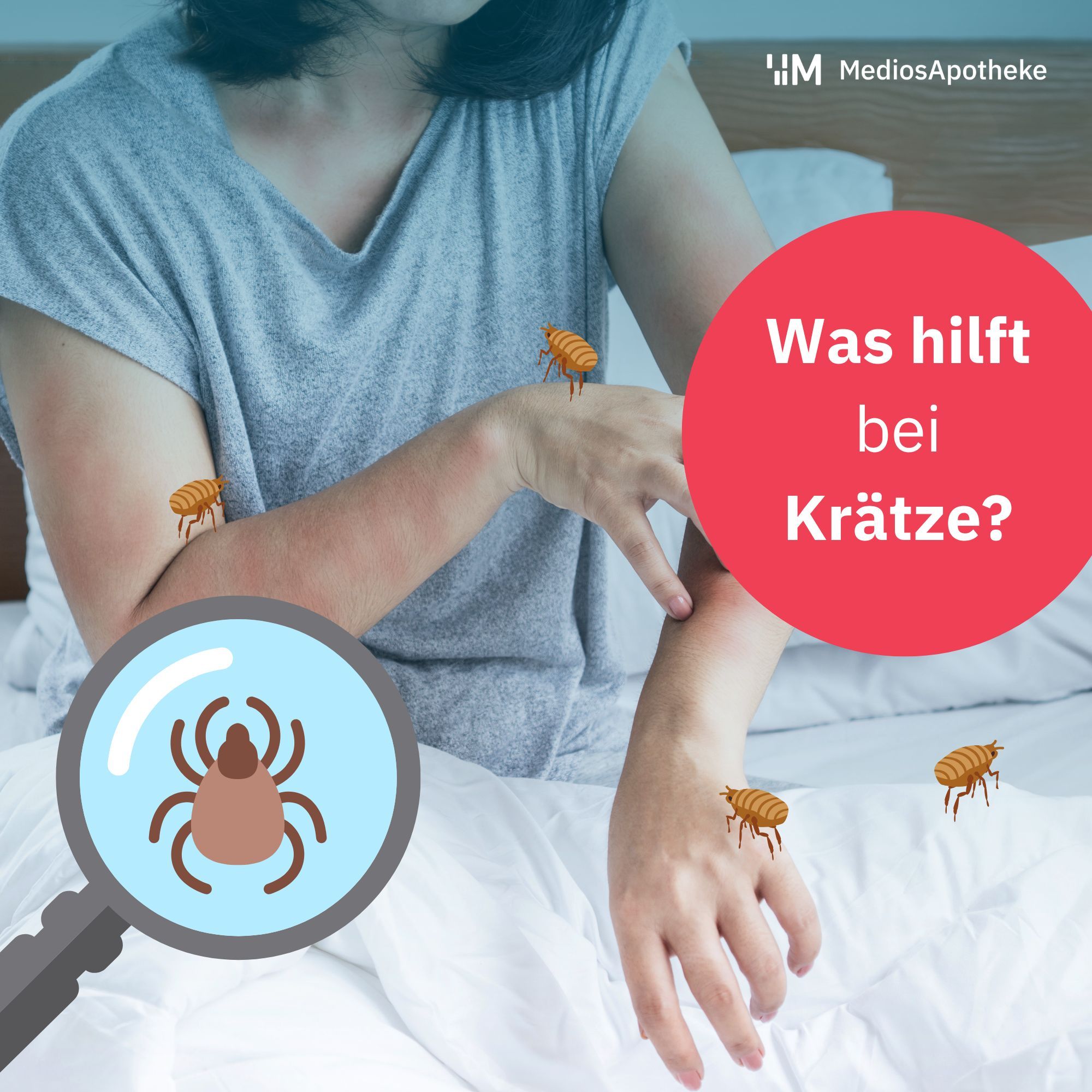 Krätze! Wir enttabuisieren den Befall und klären dich über die Skabies Milben auf!