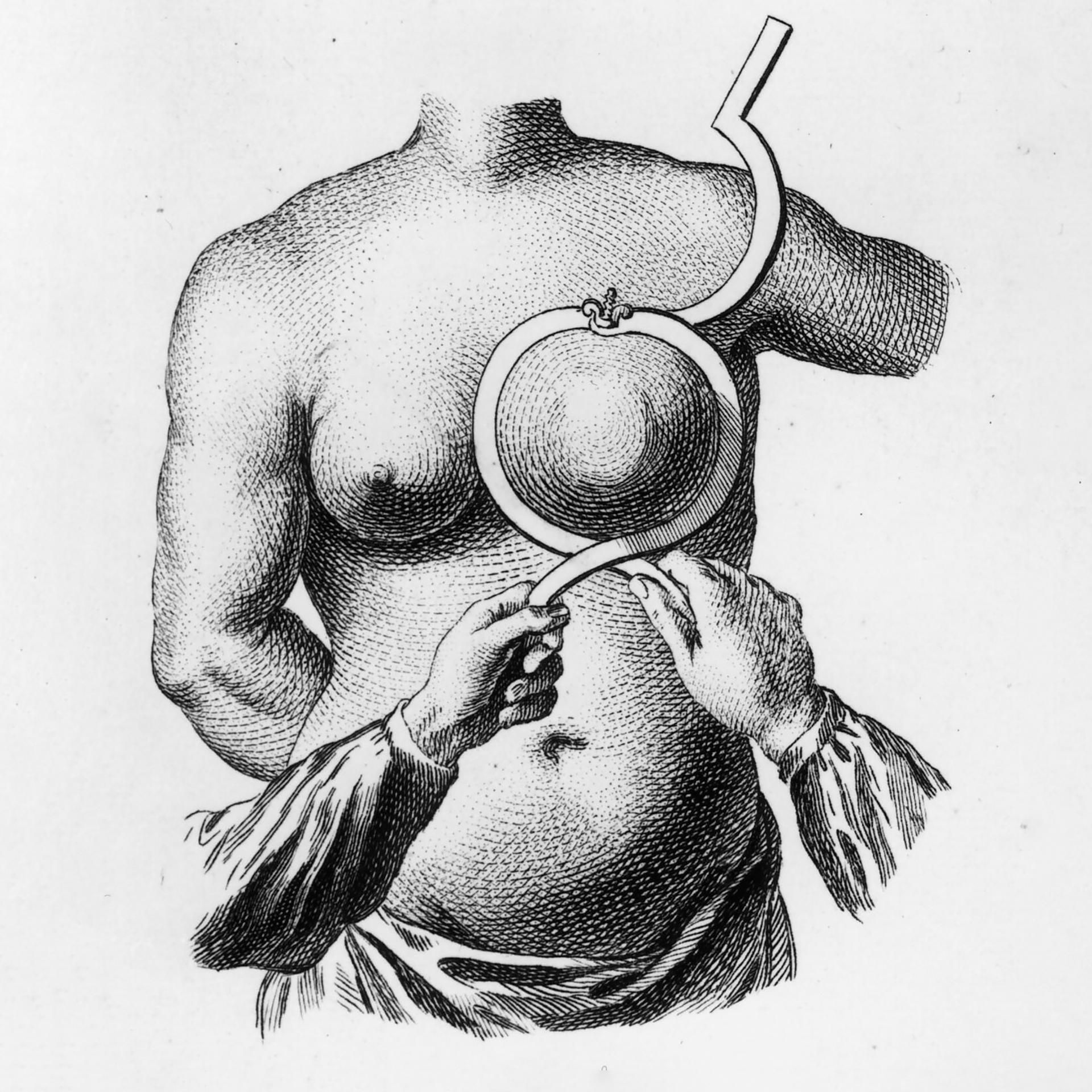 Krebs - Der Angstgegner