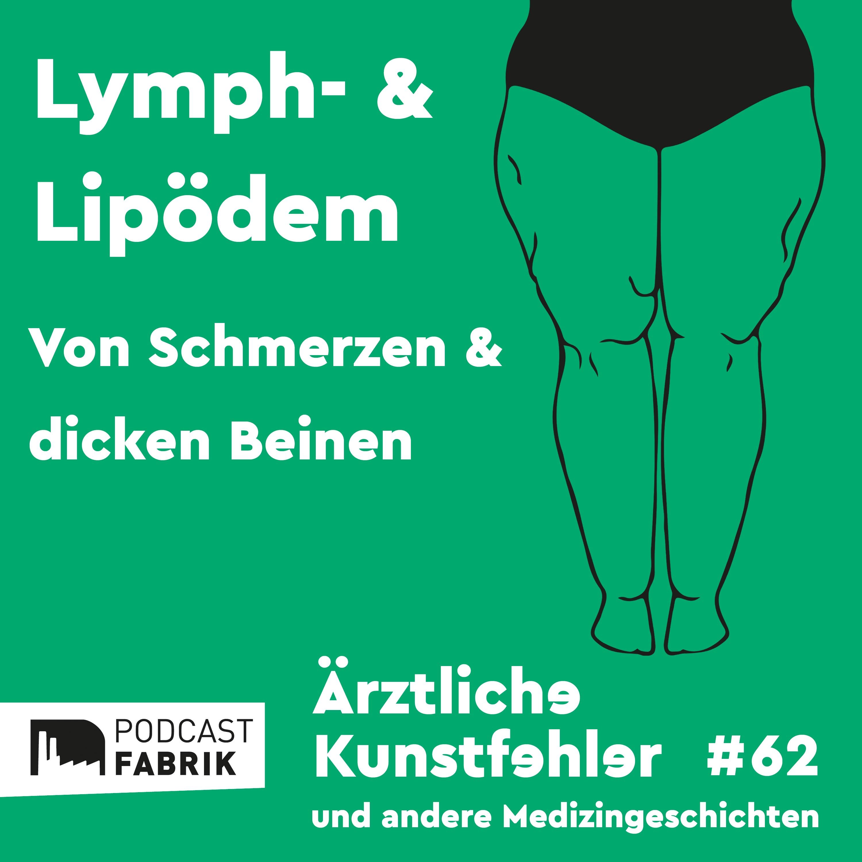 Lymph- und Lipödem - von Schmerzen und dicken Beinen