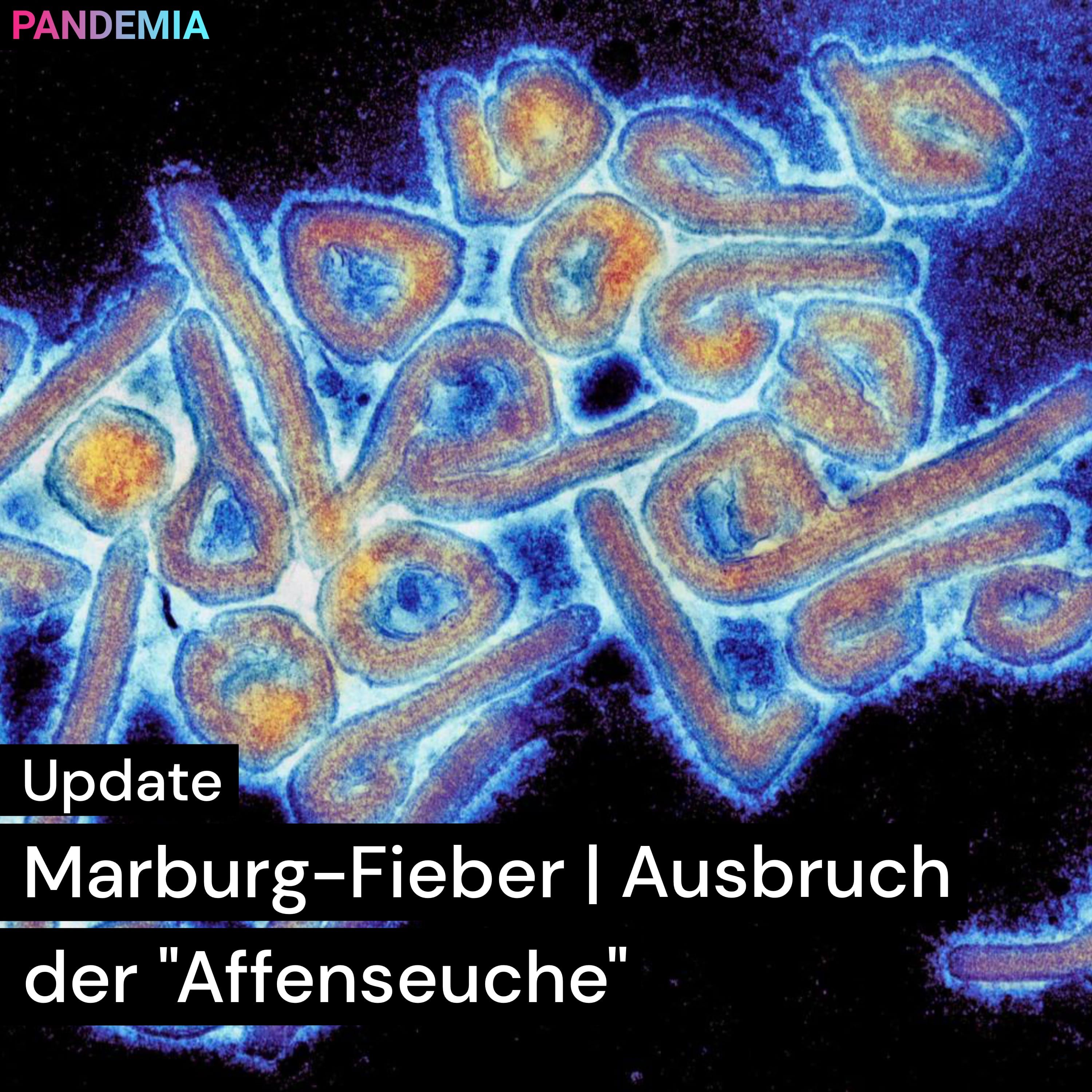 Marburg-Fieber | Ausbruch der „Affenseuche"