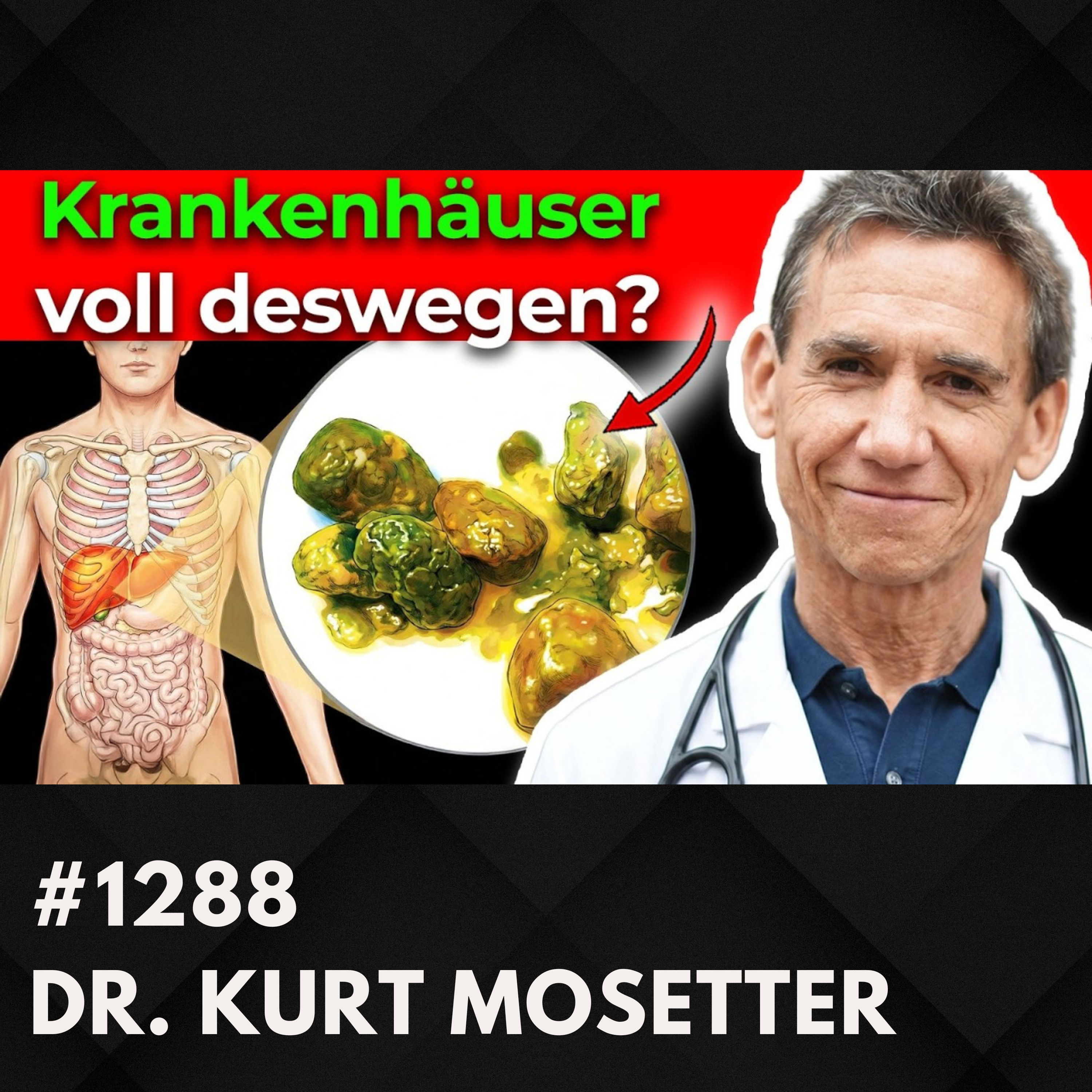 Medizin SCHOCKIERT: Mehr Deutsche betroffen als gedacht? | Dr. Kurt Mosetter #1288