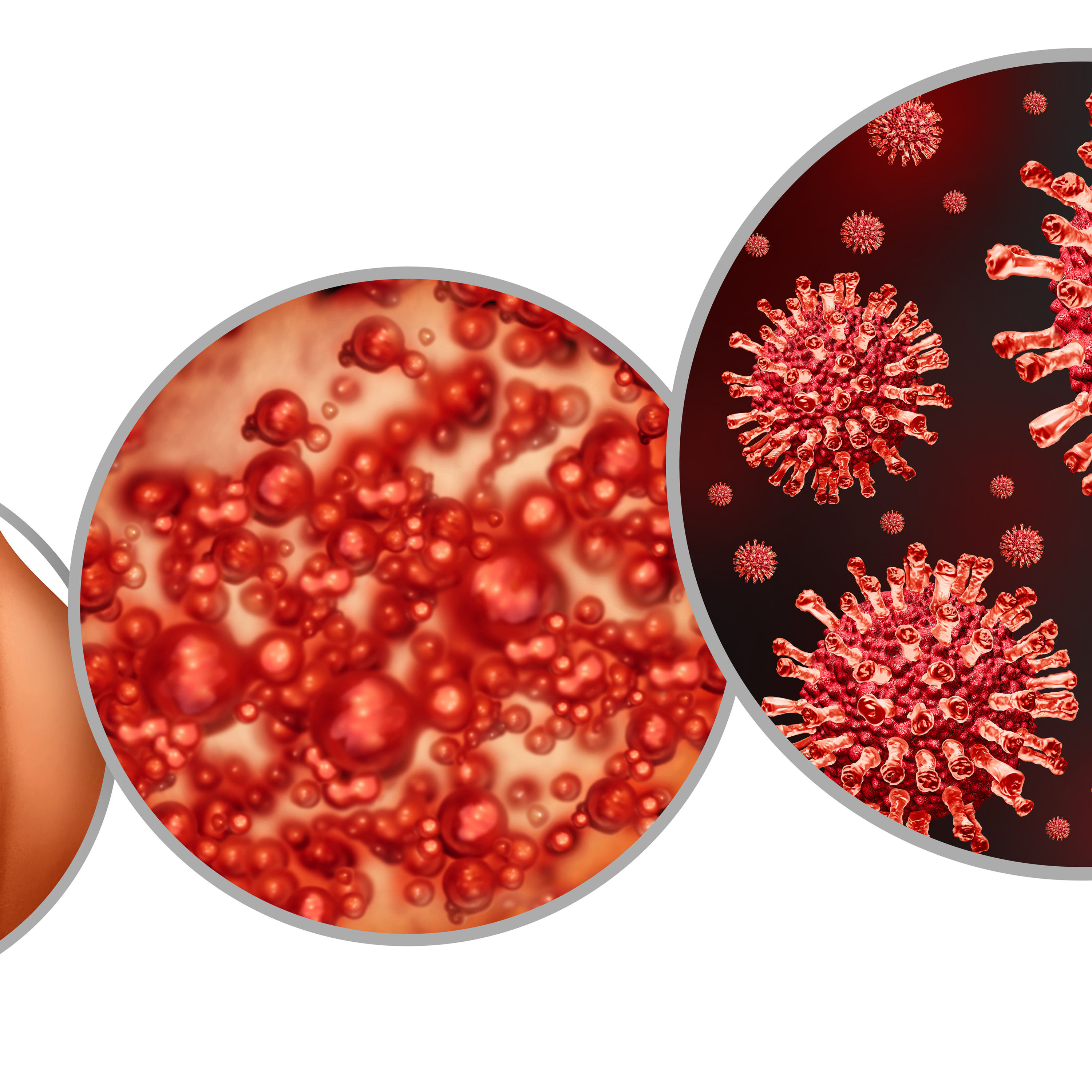 meiersworld.de - Let´s talk about Gürtelrose