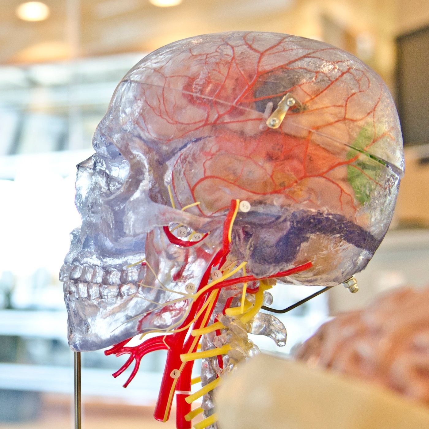 MR 19 - Alzheimer – Das Vergessen lässt sich (noch) nicht aufhalten (Teil 2)