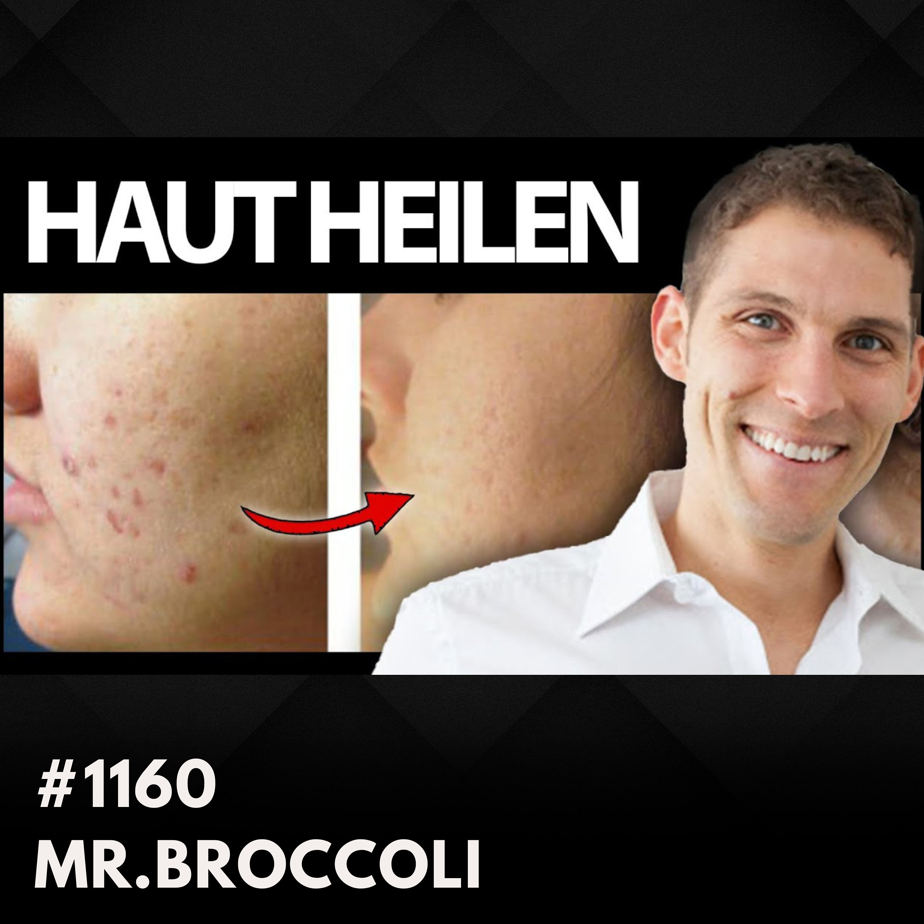 Neurodermitis: meine besten Tipps! | mr.broccoli #1160