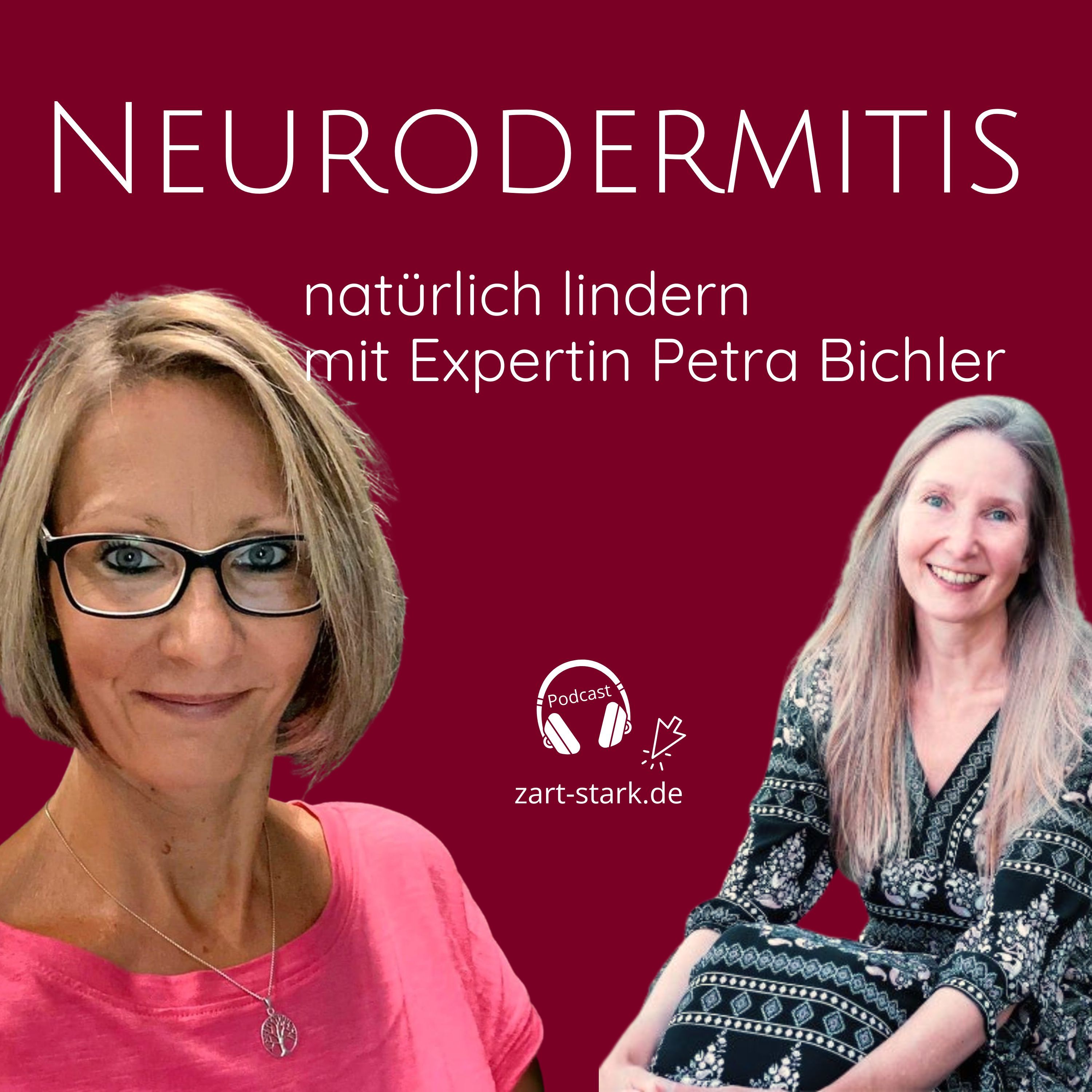 Neurodermitis natürlich lindern