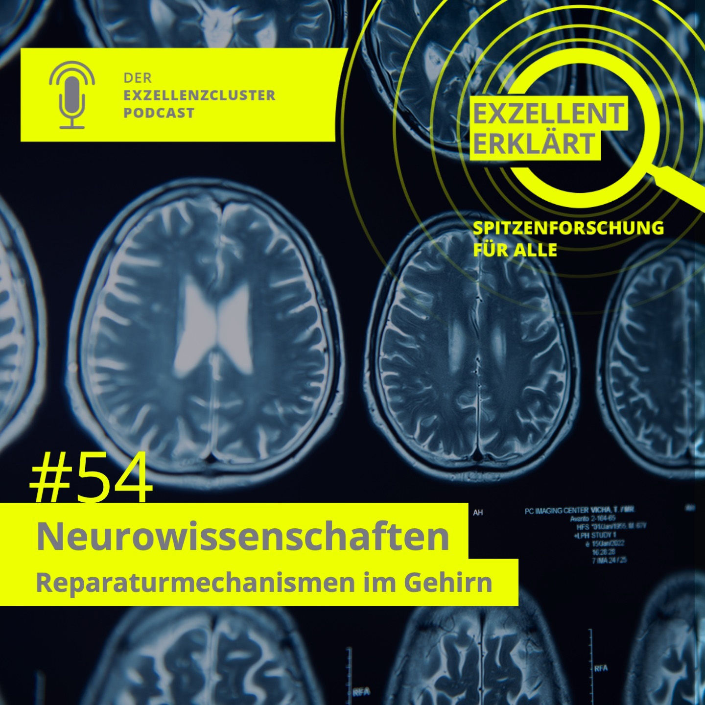 Neurowissenschaften: Reparaturmechanismen im Gehirn