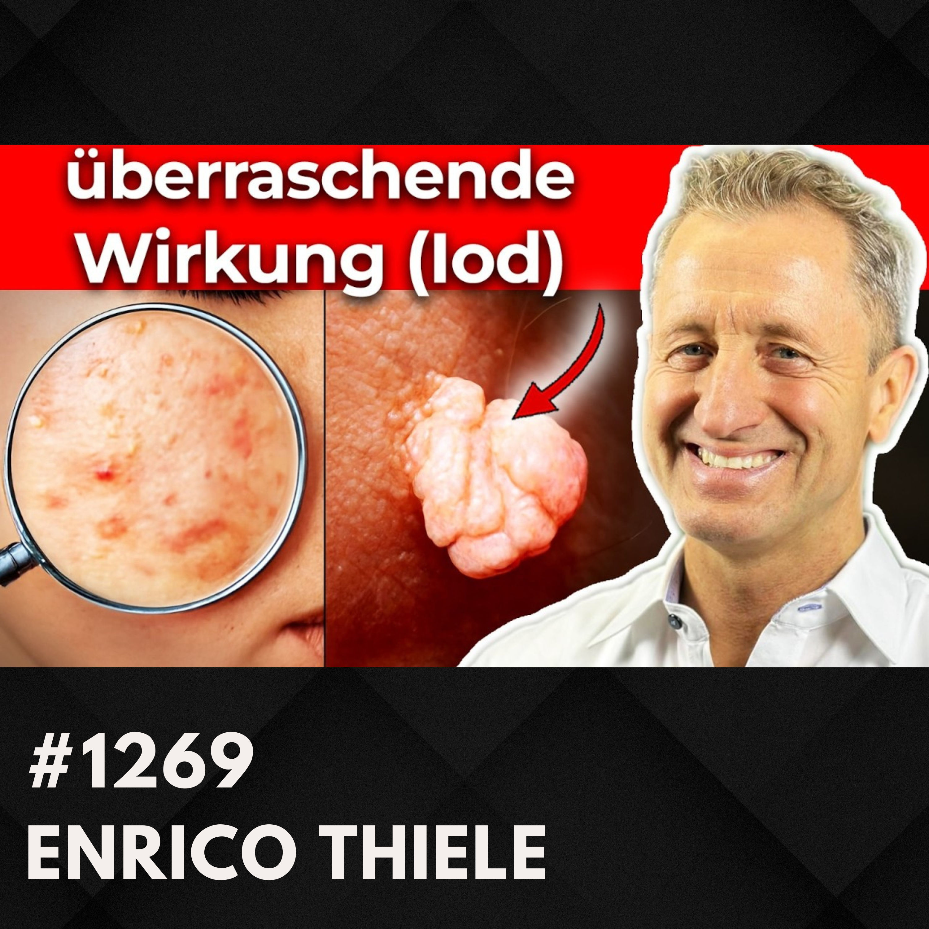 Nr. 1 Methode repariert Schilddrüse? | Enrico Thiele #1269