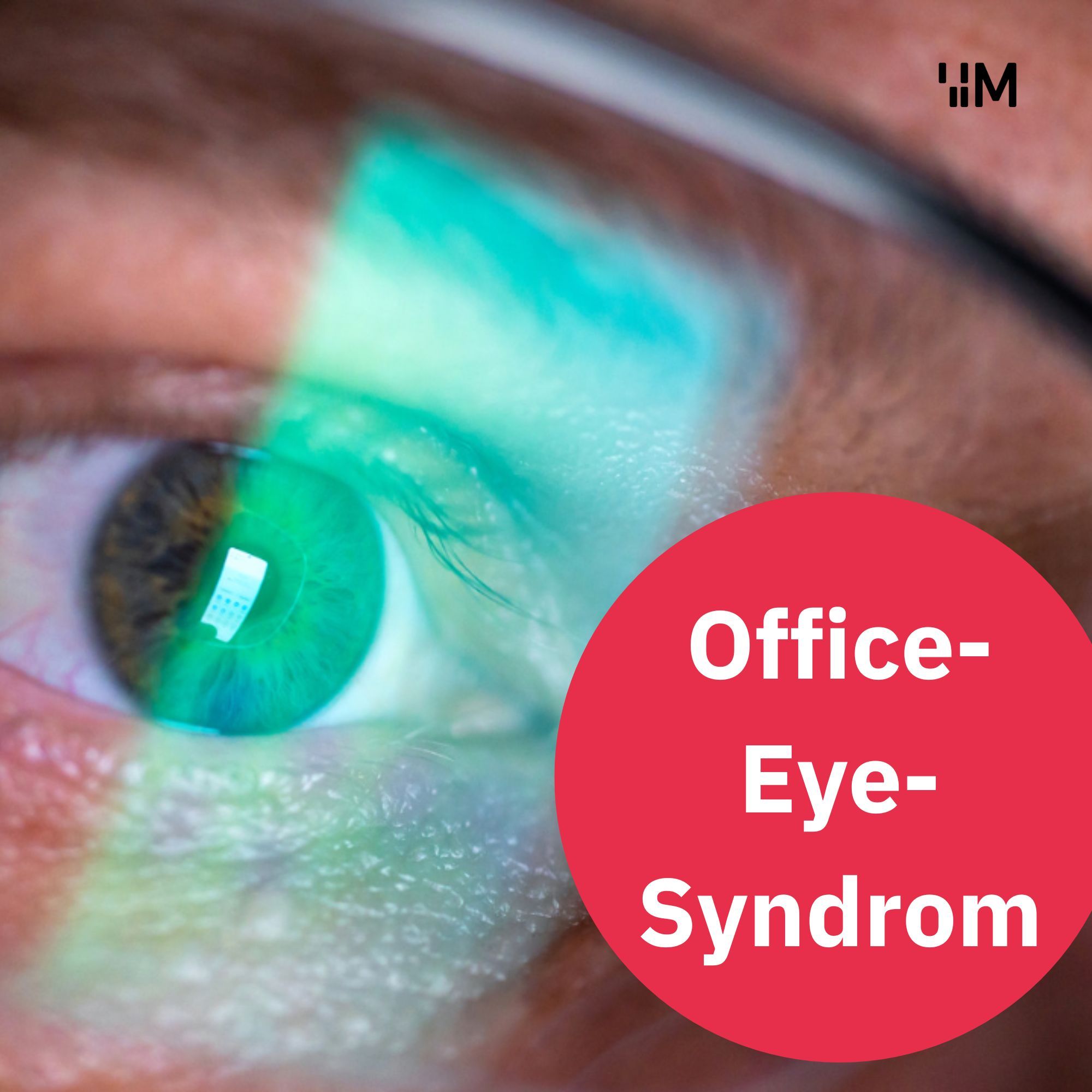 Office Eye Syndrom: Computer, Laptop Handy - lange Bildschirmzeiten trocknen deine Augen aus!