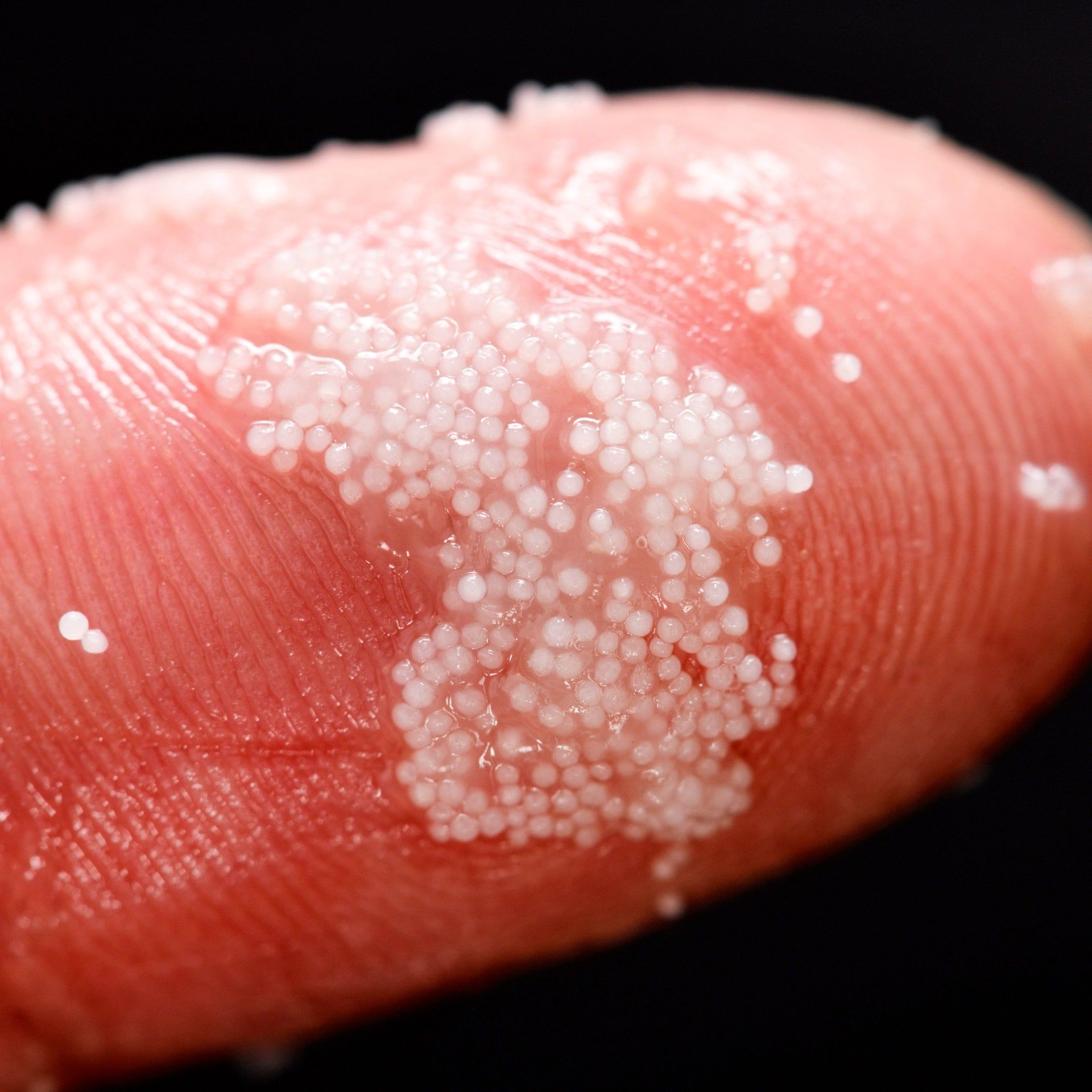 Plastikpartikel könnten Darmentzündungen verstärken