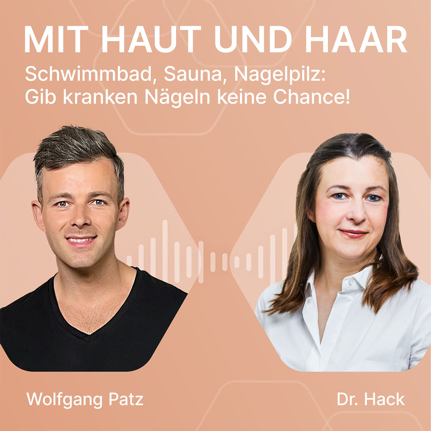 Schwimmbad, Sauna, Nagelpilz: Gib kranken Nägeln keine Chance!