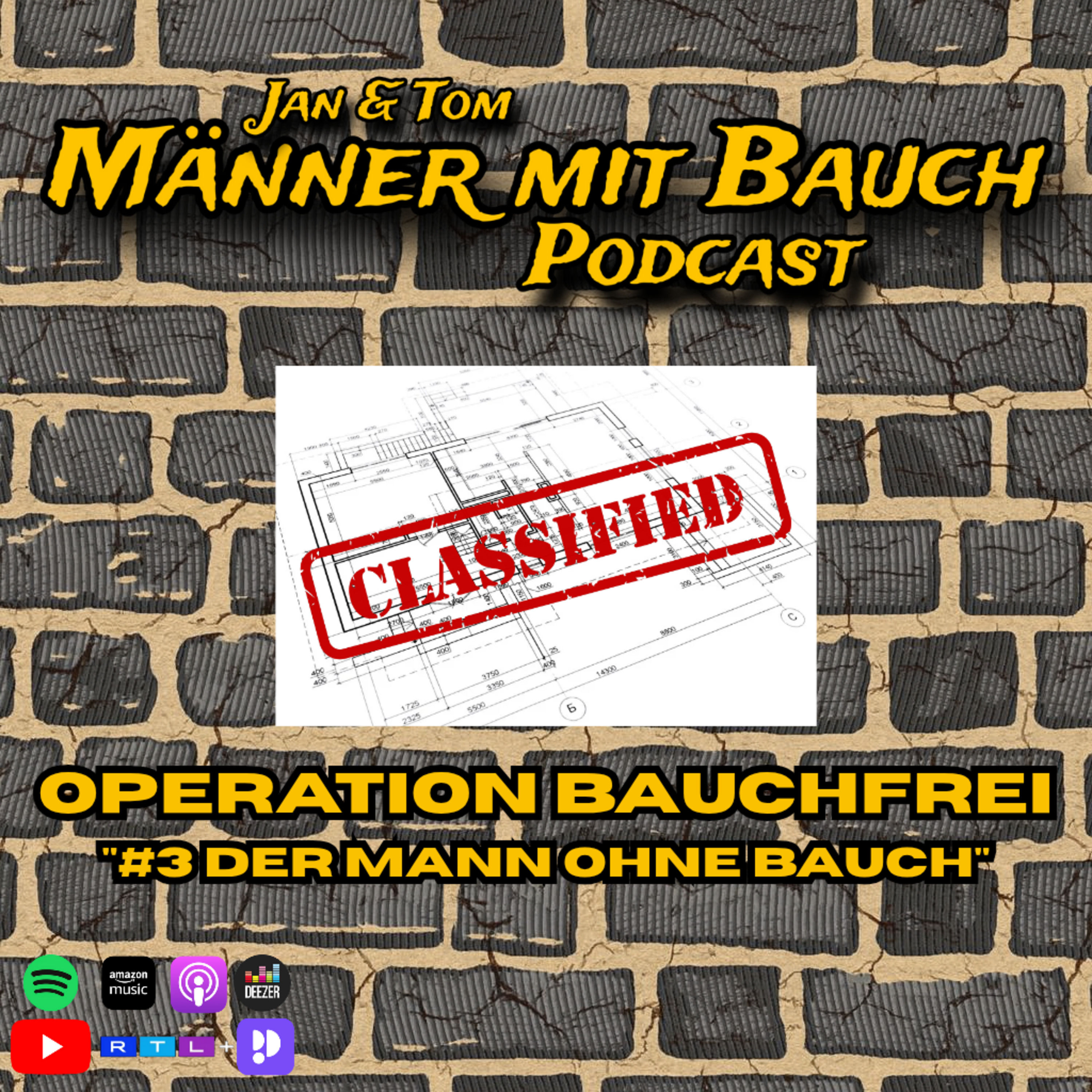 Special: #3 Operation Bauchfrei: Der Mann ohne Bauch