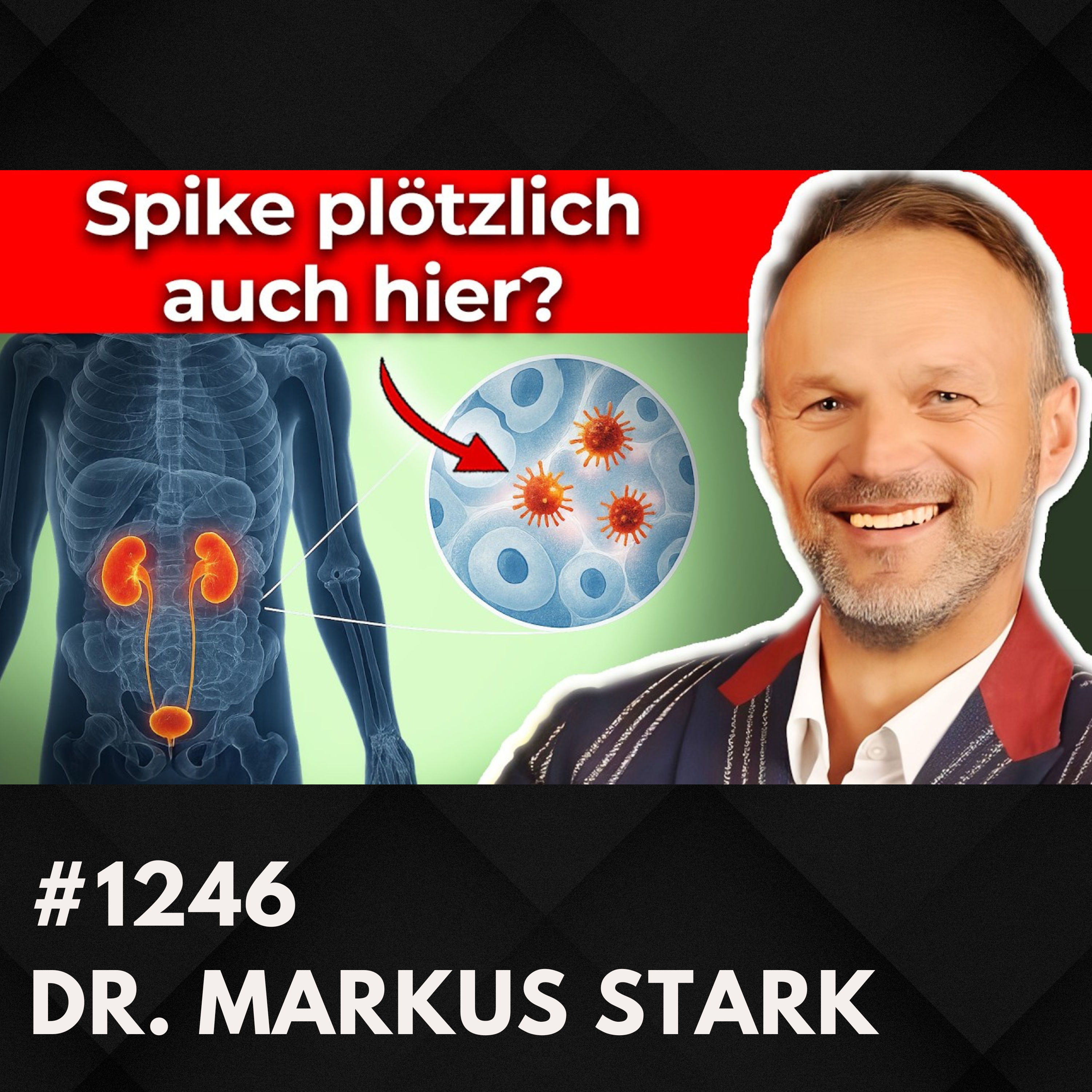 SPIKE und chronische Müdigkeit außer Kontrolle? (Dr. klärt auf) | Dr. Markus Stark #1246