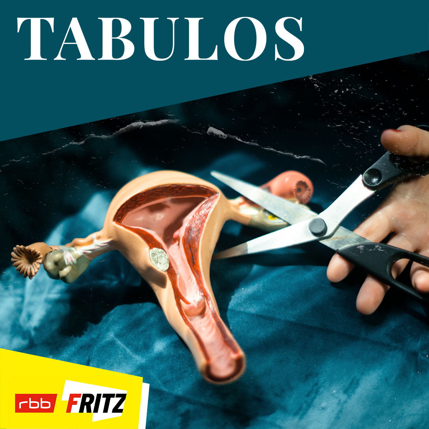 Sterilisation – Susanne will keine eigenen Kinder