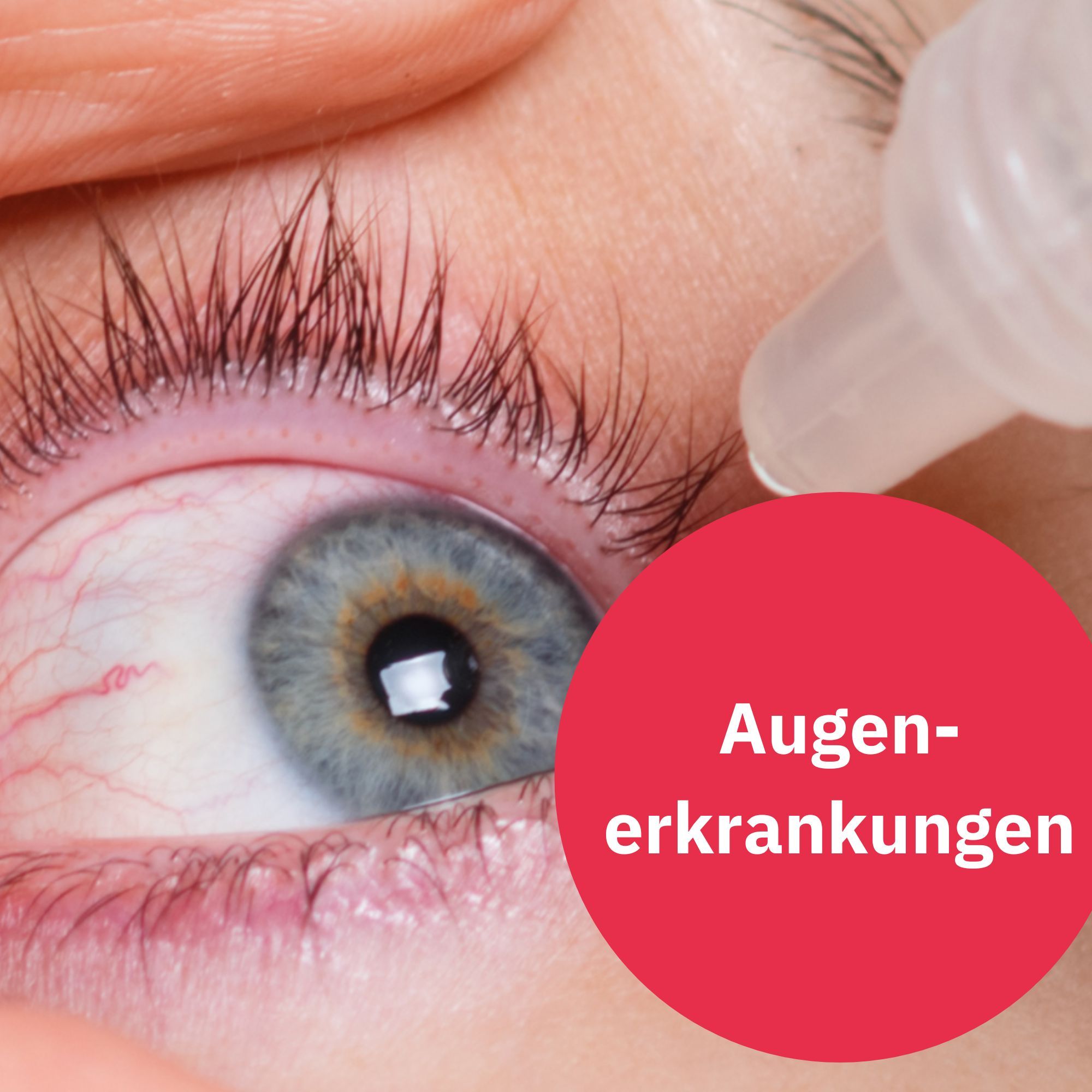 Trockene Augen, Bindehautentzündung, Gerstenkorn - Wertvolle Tipps aus der Apotheke